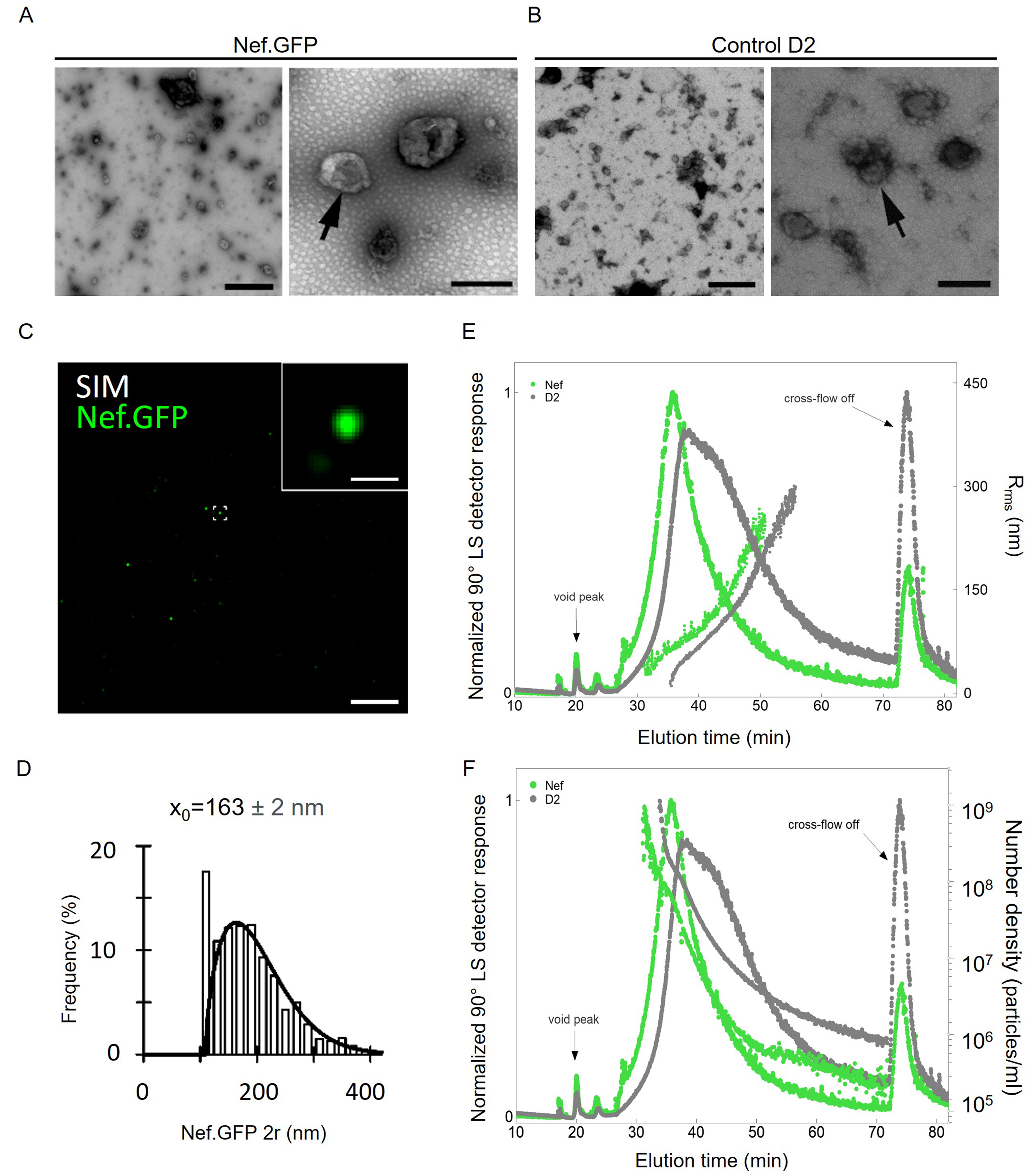 HIV protein Nef expression in human microglia drives the release of distinct Nef-containing extracellular vesicles