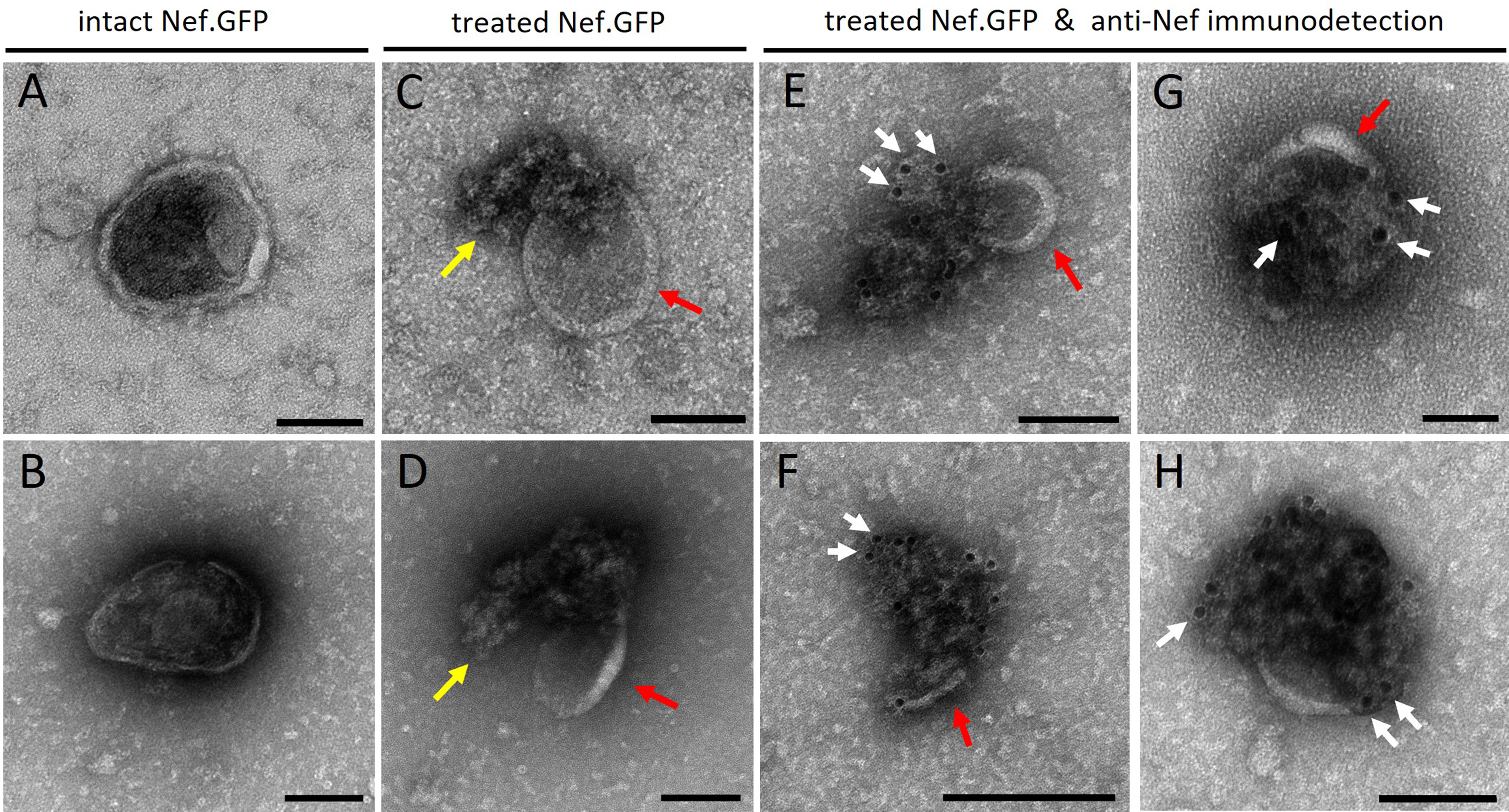 HIV protein Nef expression in human microglia drives the release of distinct Nef-containing extracellular vesicles