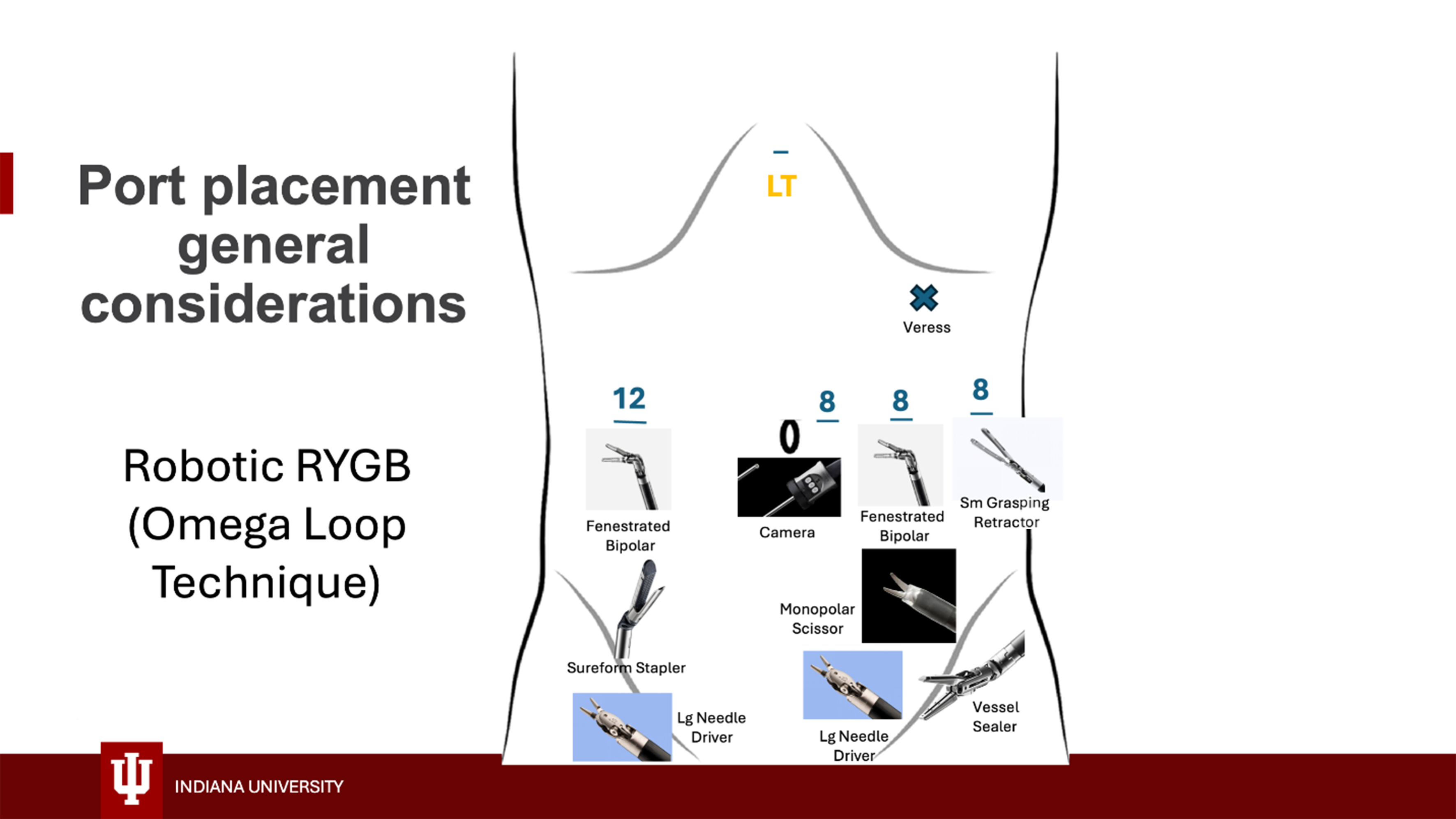 Technical considerations for robotic gastric bypass: comparing traditional and omega loop techniques