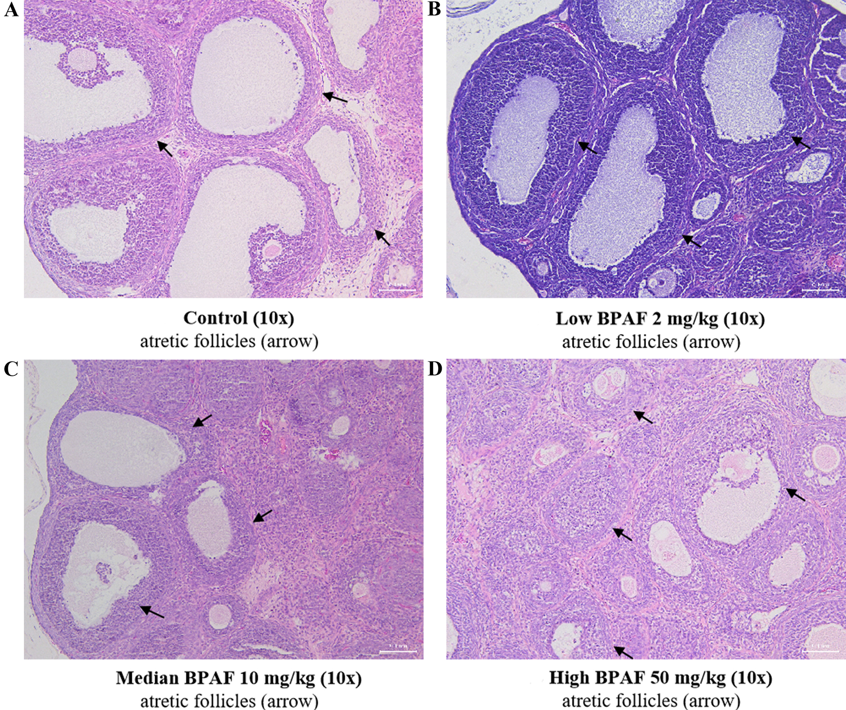 Effects of gestational and lactational bisphenol AF exposure on female offspring reproductive function during two developmental stages