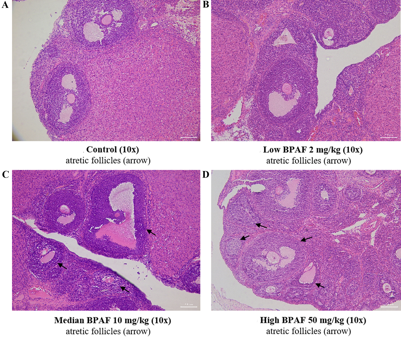 Effects of gestational and lactational bisphenol AF exposure on female offspring reproductive function during two developmental stages