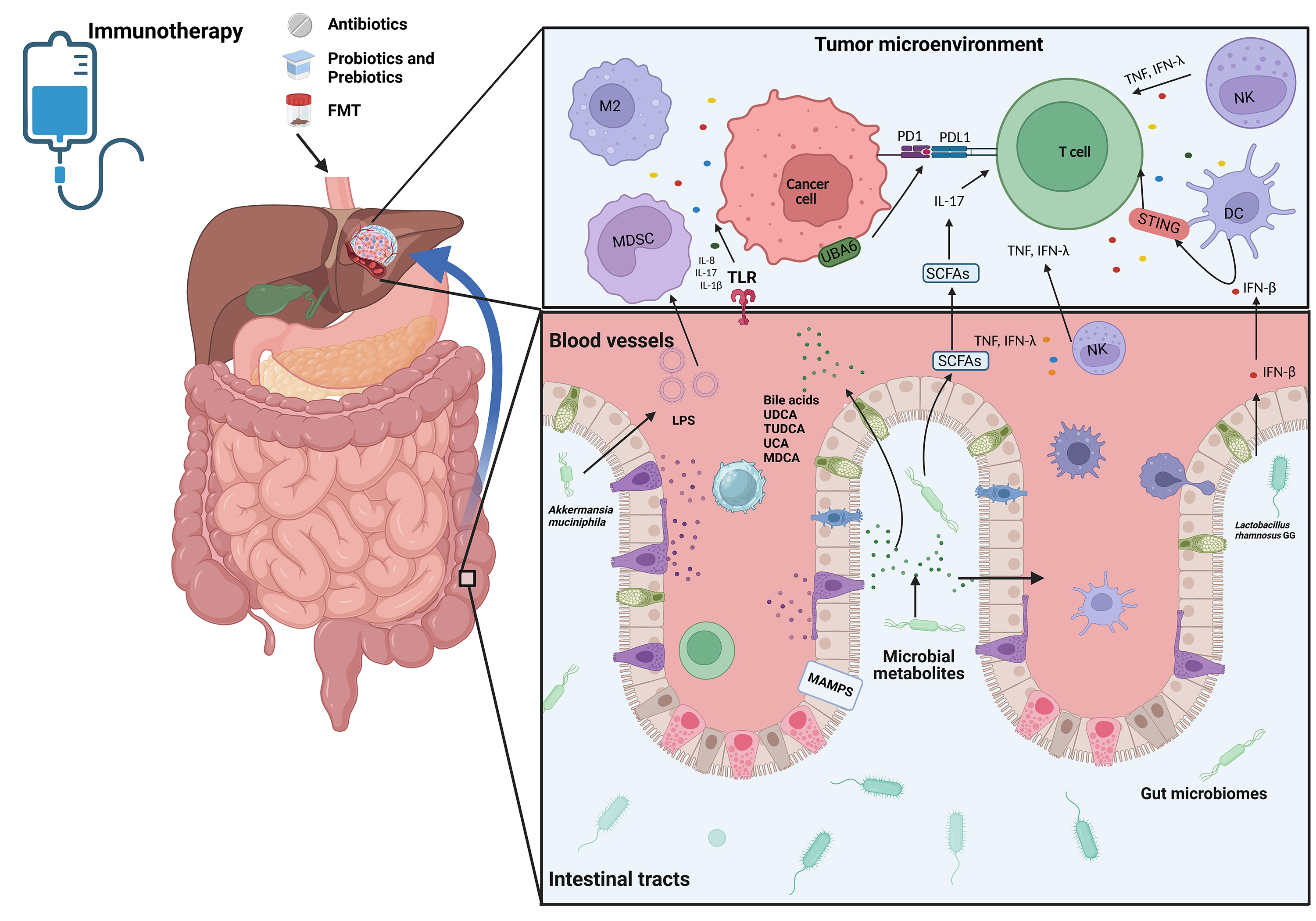 Influence of the gut microbiota on the response to immunotherapy in hepatocellular carcinoma