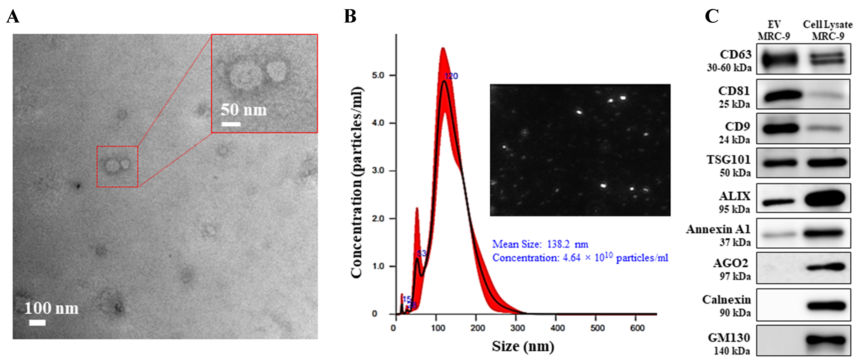 Tumor-targeted multifunctional extracellular vesicles as drug carriers for lung cancer therapy