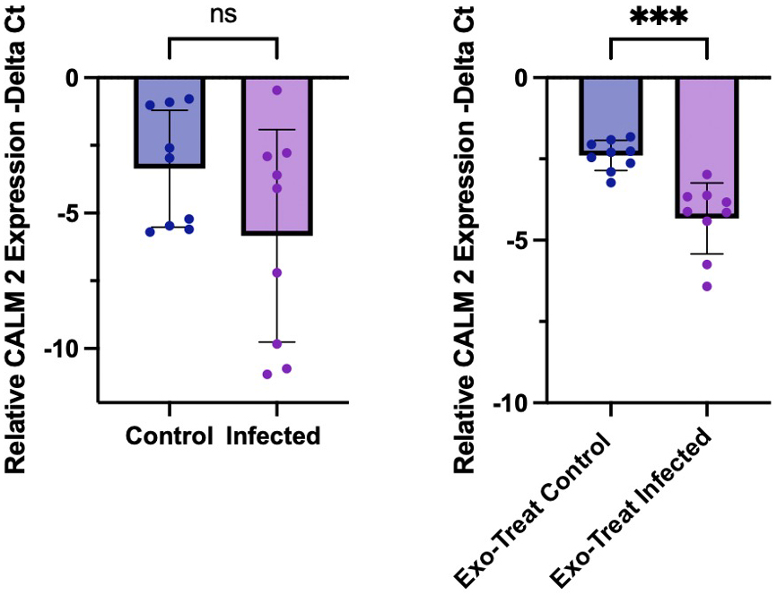 <i>Toxoplasma gondii</i> infection induces extracellular vesicle miRNAs in synaptic plasticity and neural mechanisms