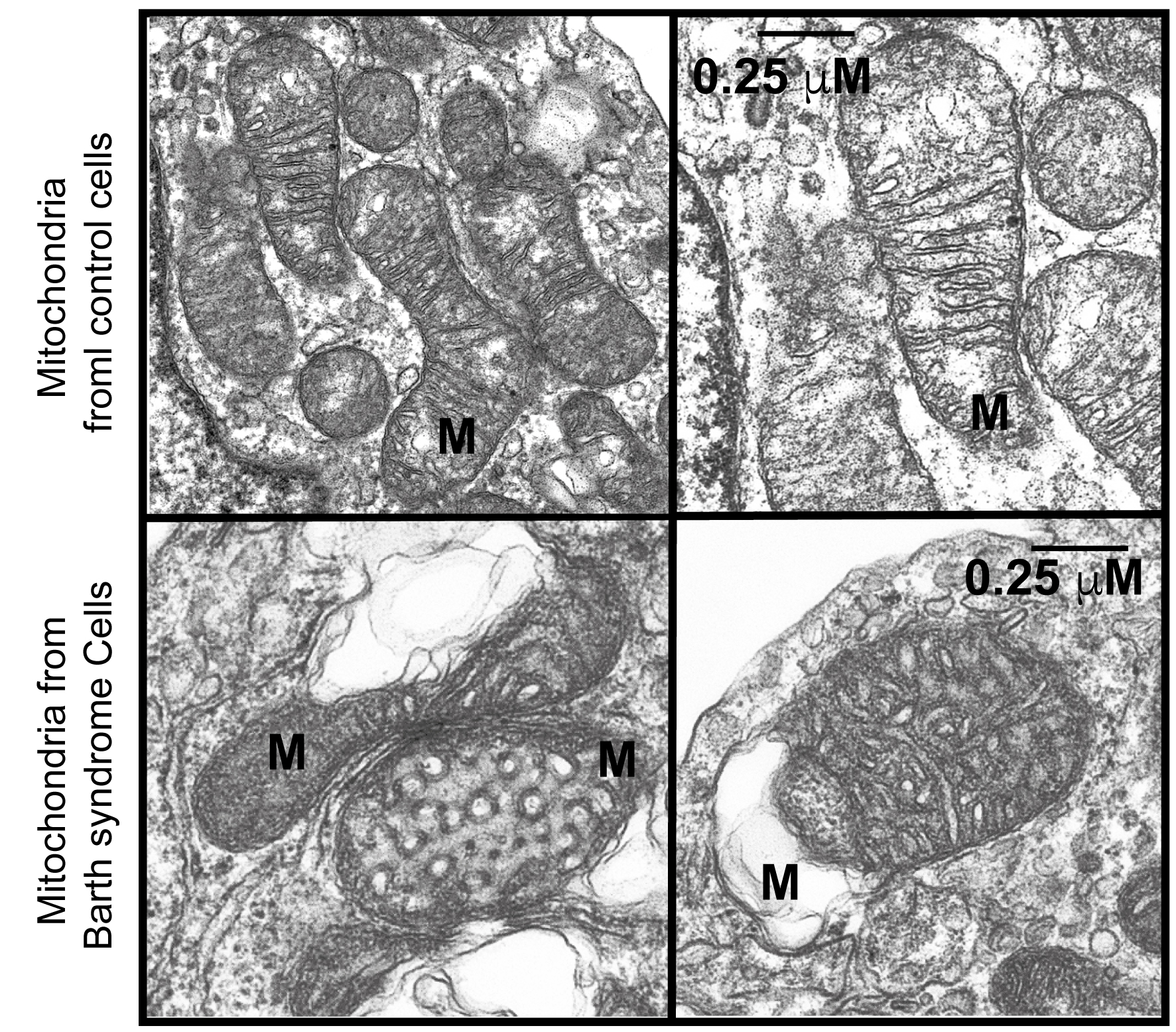Cellular ATP levels alone do not reliably reflect overall mitochondrial bioenergetics or mitochondrial dysfunction in Barth syndrome