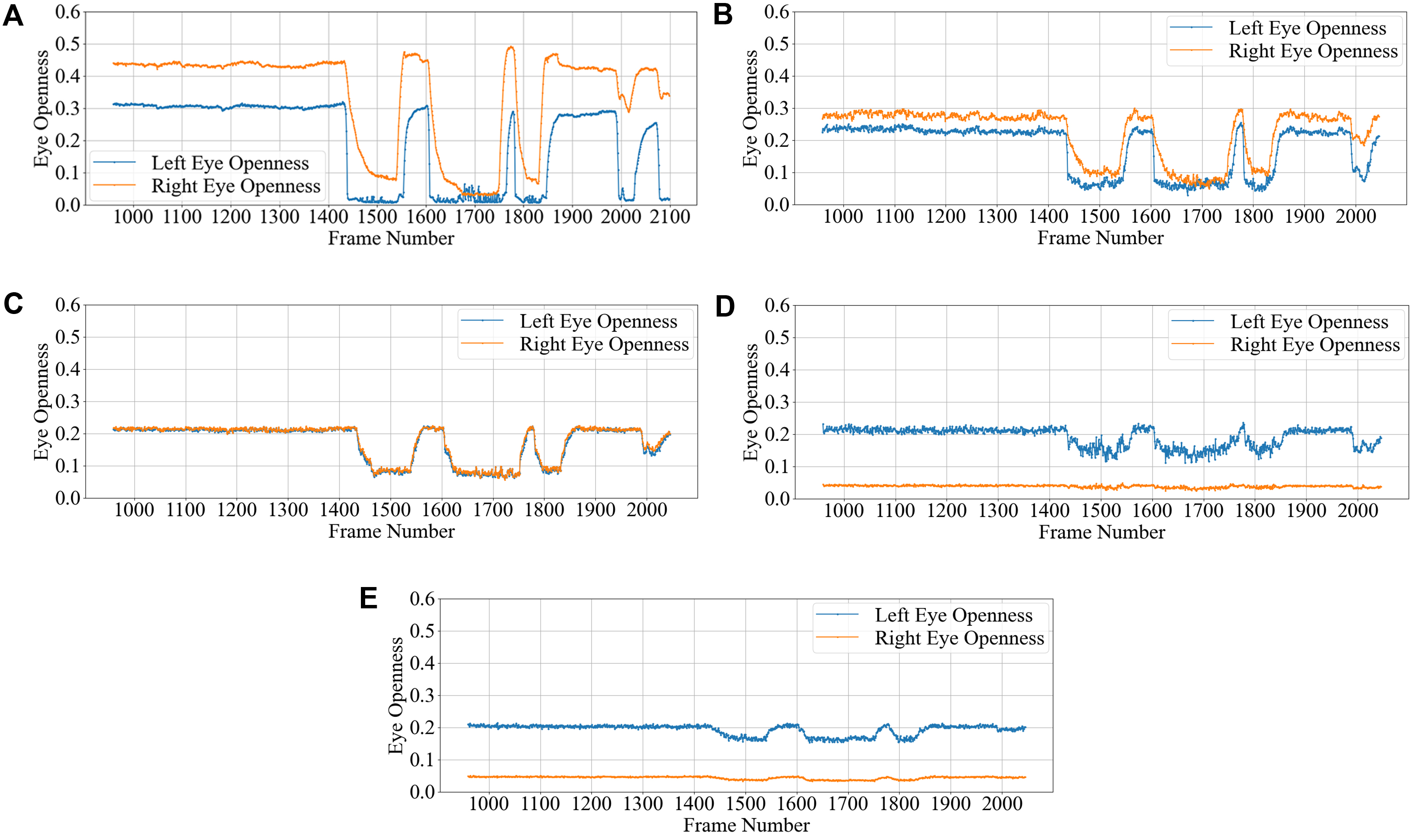 Assistive assessment of neurological dysfunction via eye movement patterns and ocular biometrics