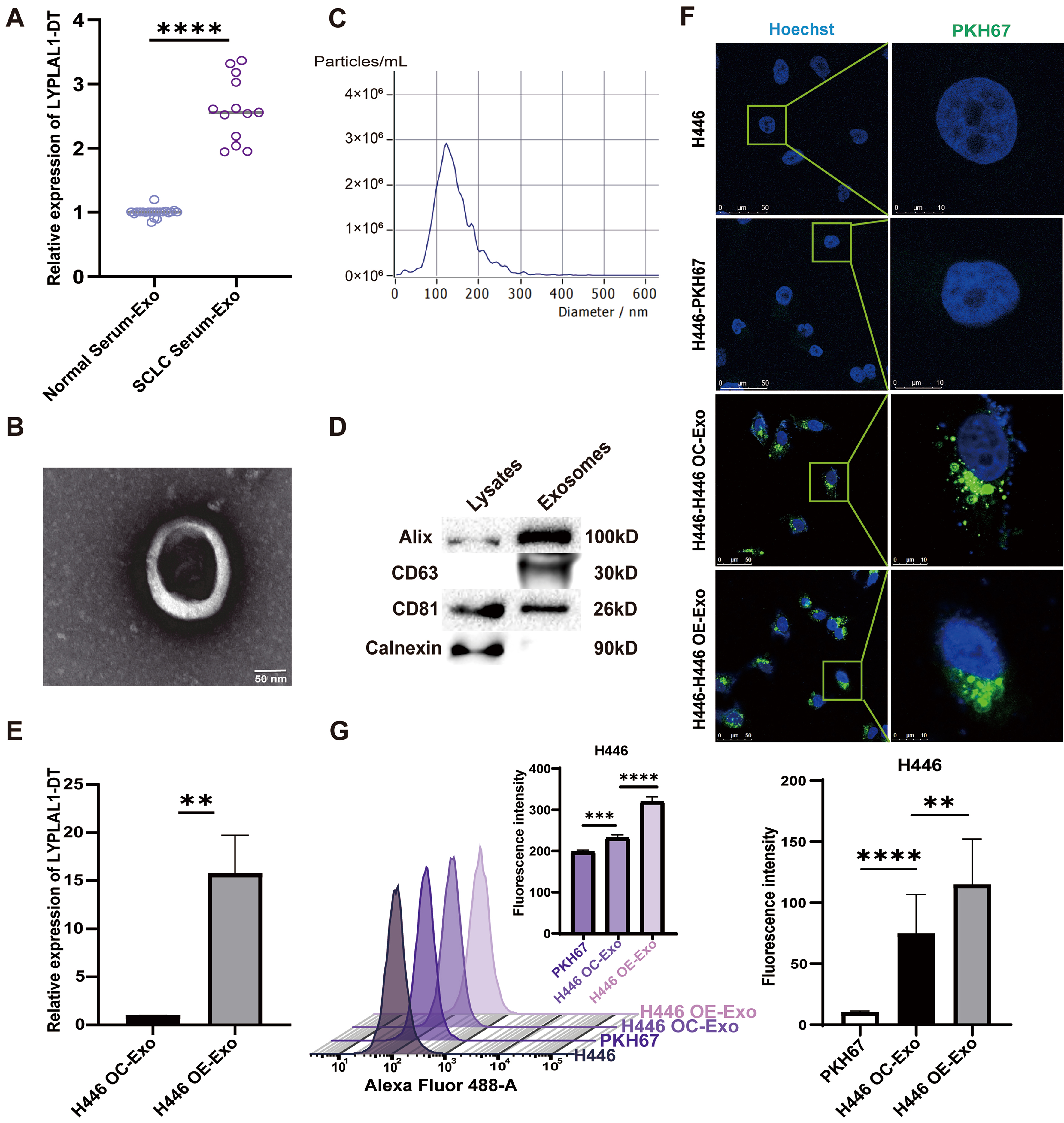 Extracellular vesicle-associated lncRNA LYPLAL1-DT mediates endothelial-cancer cell communication, promoting small cell lung cancer progression
