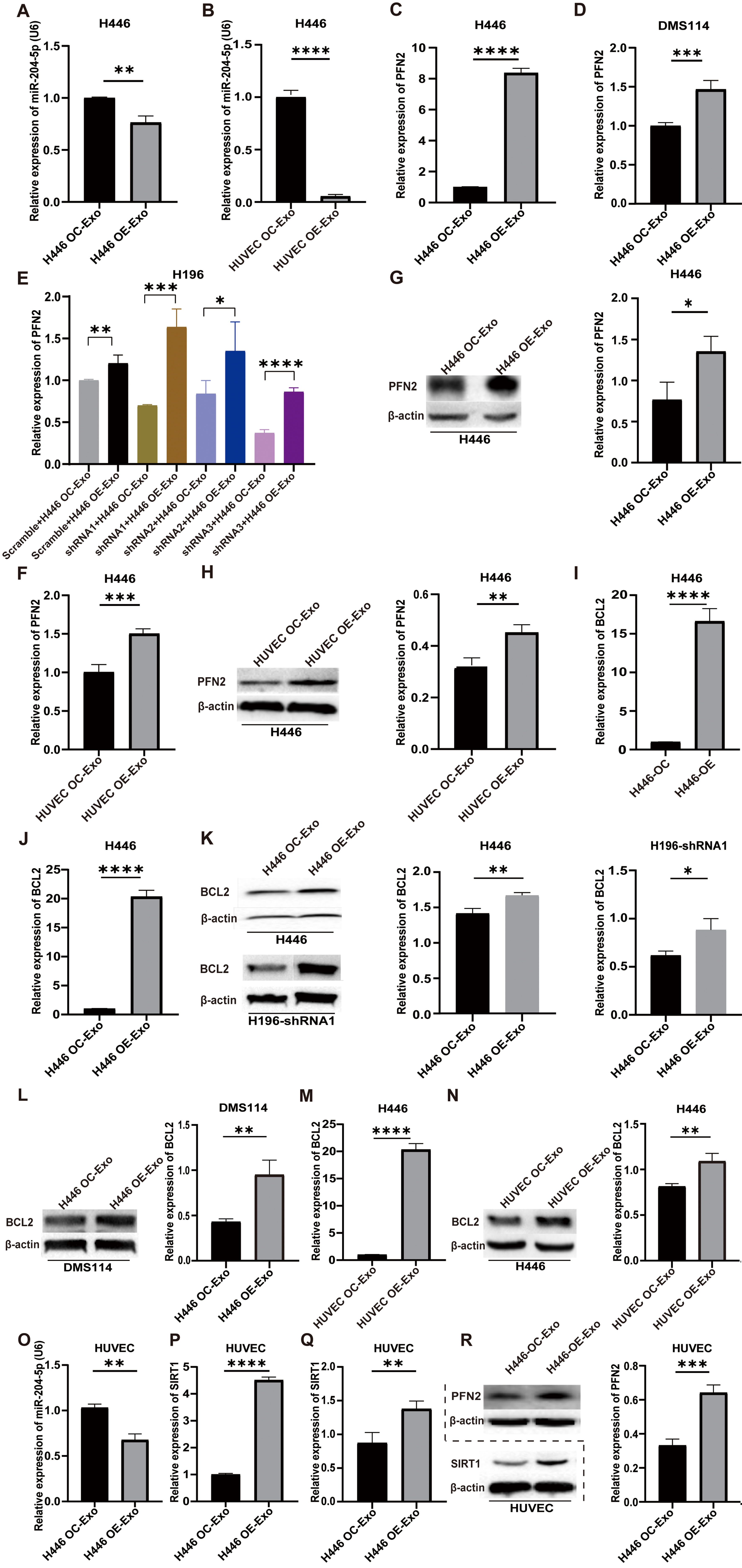 Extracellular vesicle-associated lncRNA LYPLAL1-DT mediates endothelial-cancer cell communication, promoting small cell lung cancer progression
