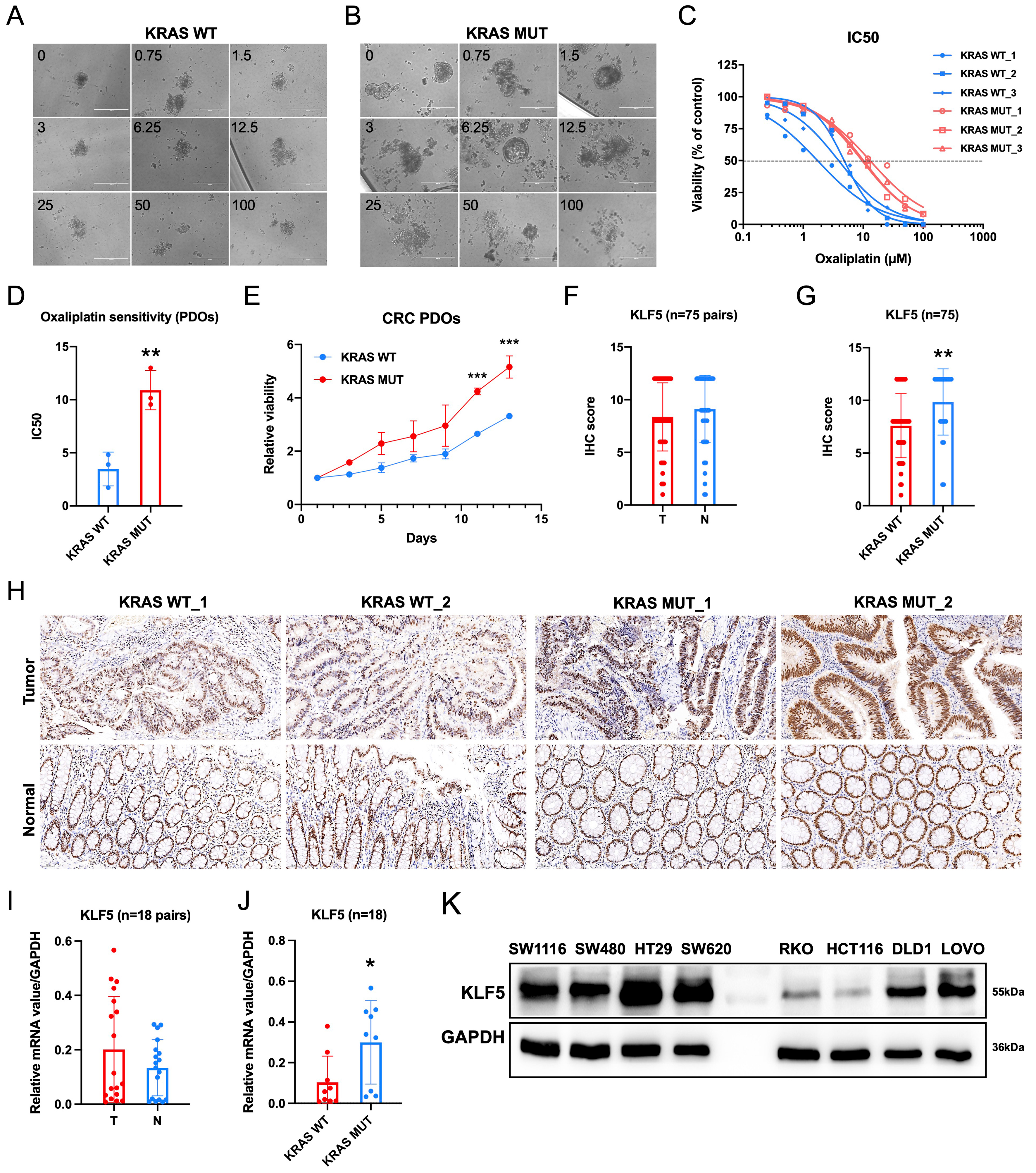 KLF5 promotes tumor proliferation and oxaliplatin resistance via chromatin remodeling in KRAS-mutated colorectal cancer