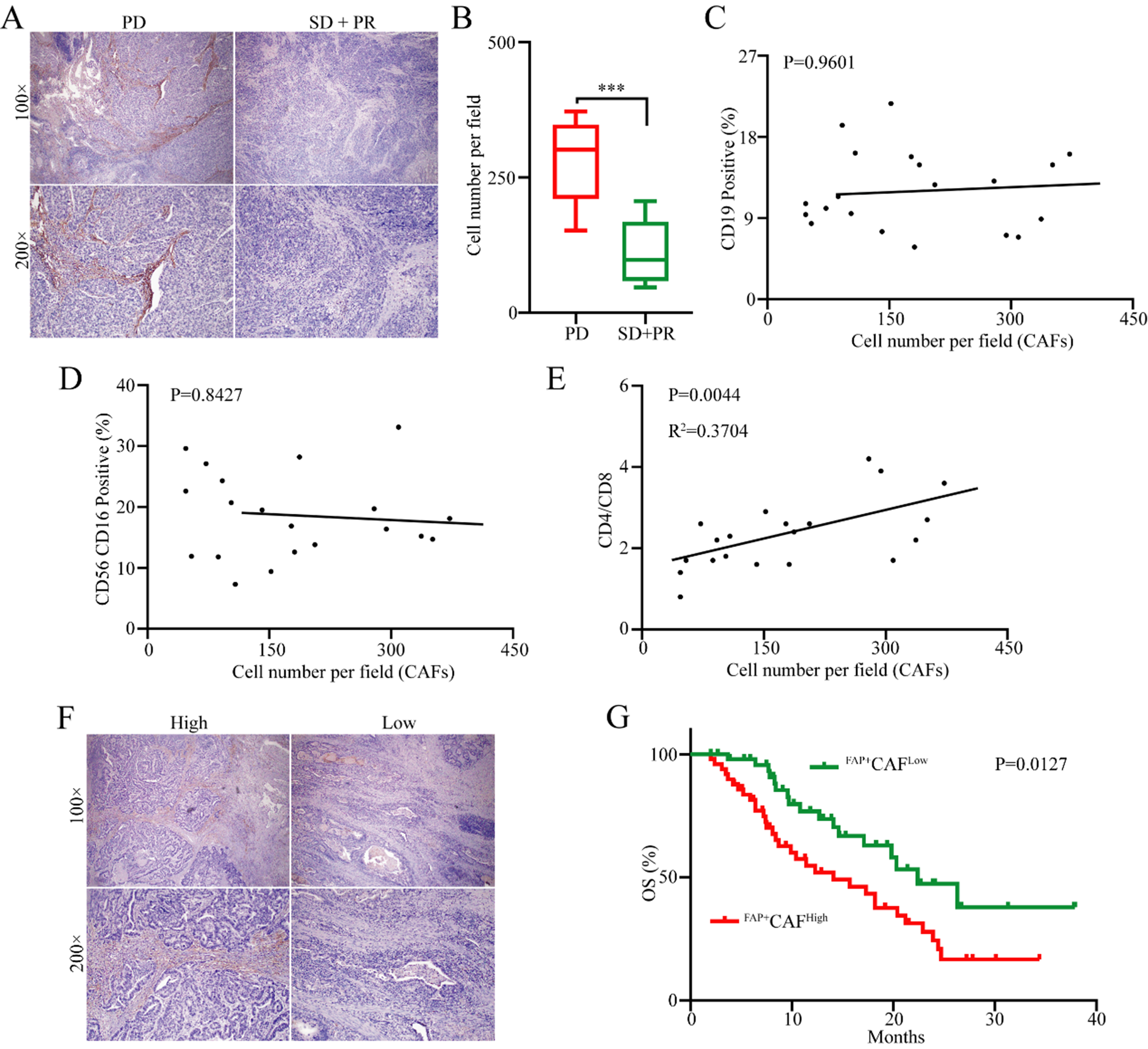 Effects of FAP<sup>+</sup> cancer-associated fibroblasts on anti-PD-1 immunotherapy and CD4<sup>+</sup> T cell polarization in gastric cancer