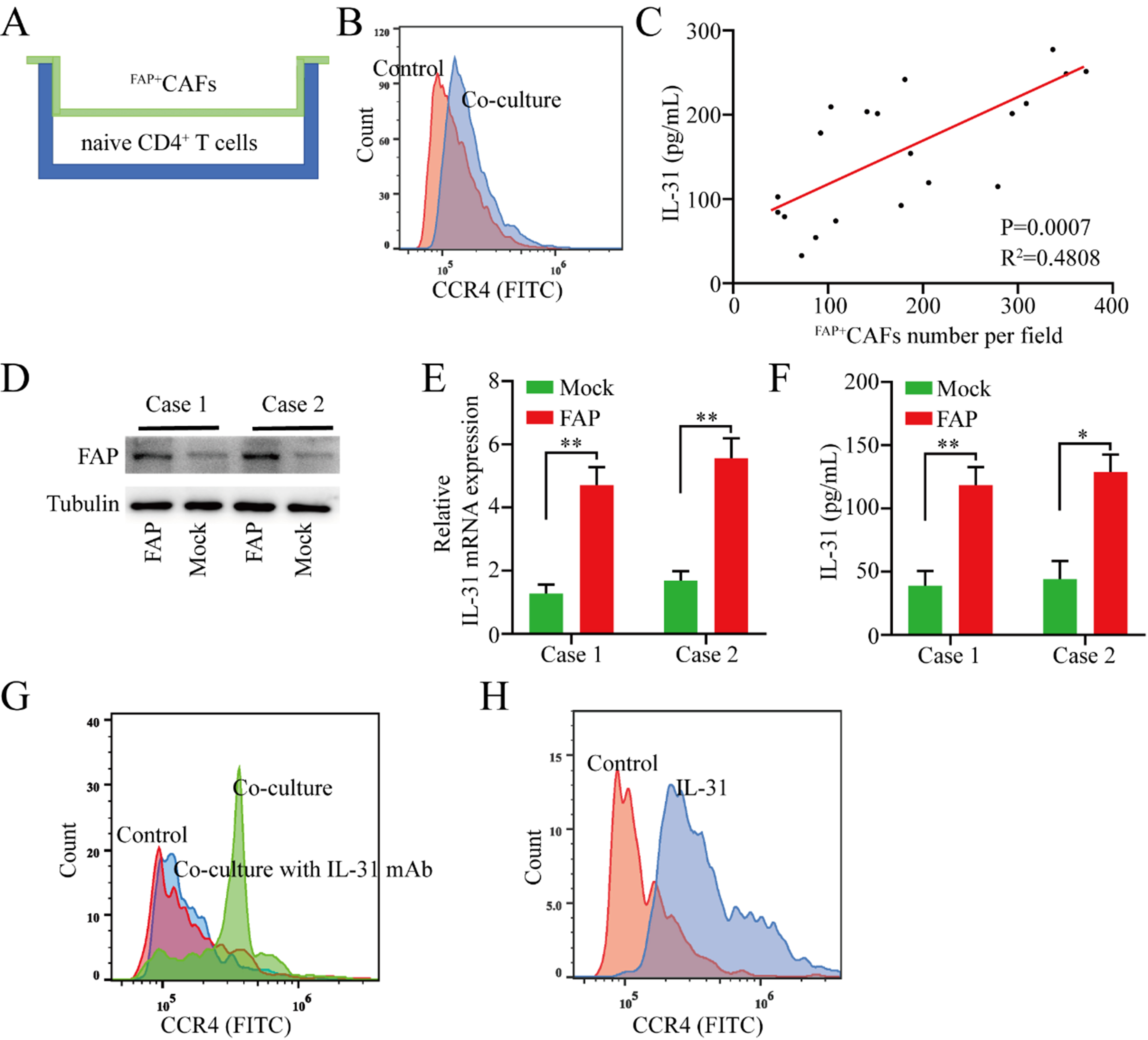 Effects of FAP<sup>+</sup> cancer-associated fibroblasts on anti-PD-1 immunotherapy and CD4<sup>+</sup> T cell polarization in gastric cancer