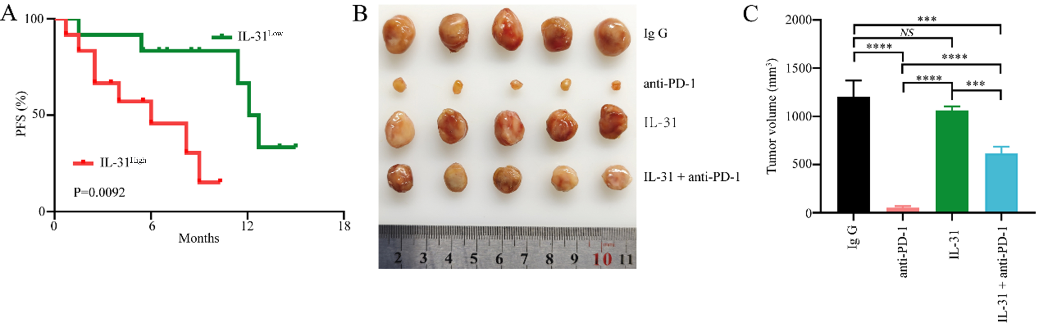 Effects of FAP<sup>+</sup> cancer-associated fibroblasts on anti-PD-1 immunotherapy and CD4<sup>+</sup> T cell polarization in gastric cancer