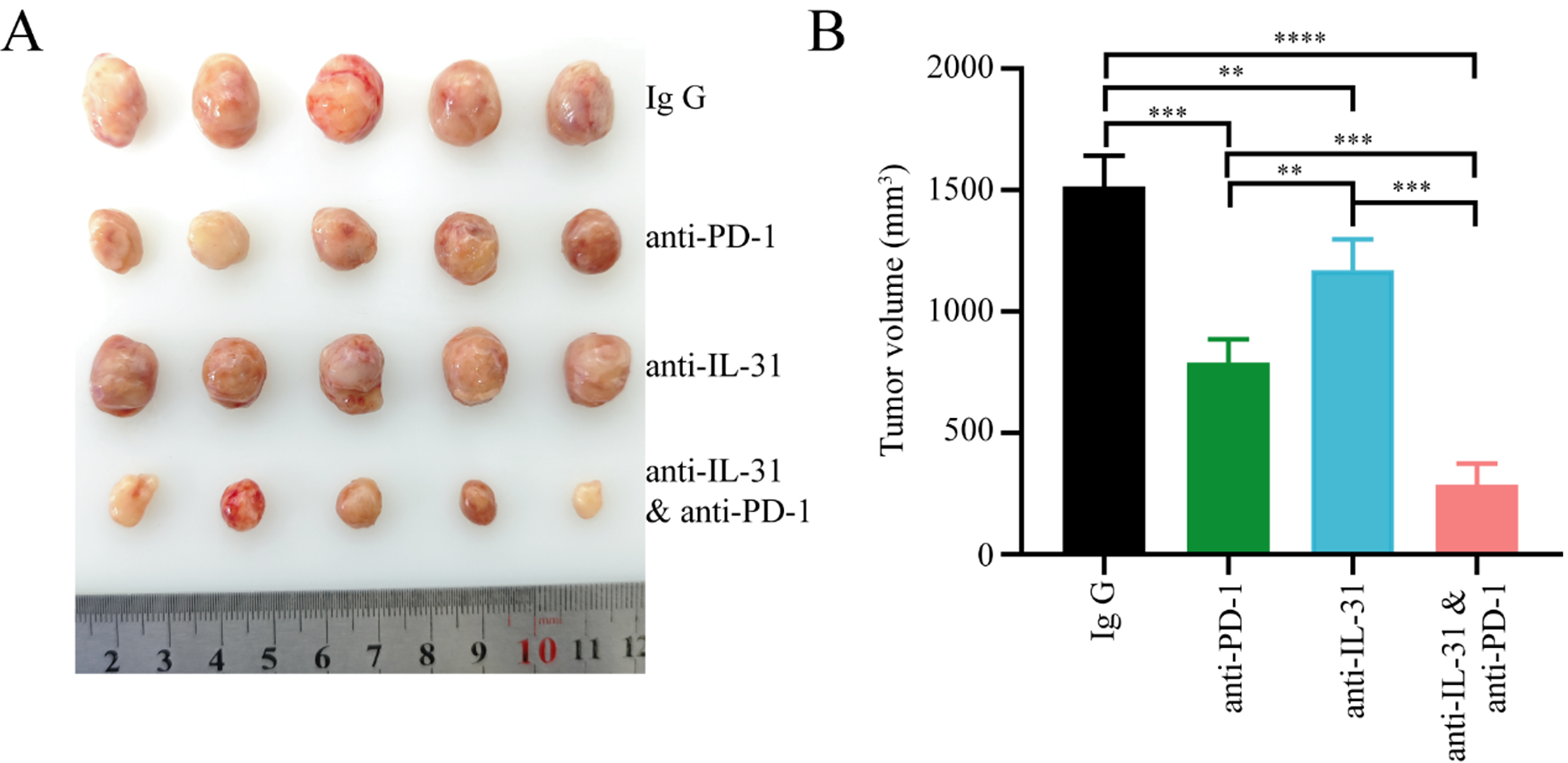 Effects of FAP<sup>+</sup> cancer-associated fibroblasts on anti-PD-1 immunotherapy and CD4<sup>+</sup> T cell polarization in gastric cancer
