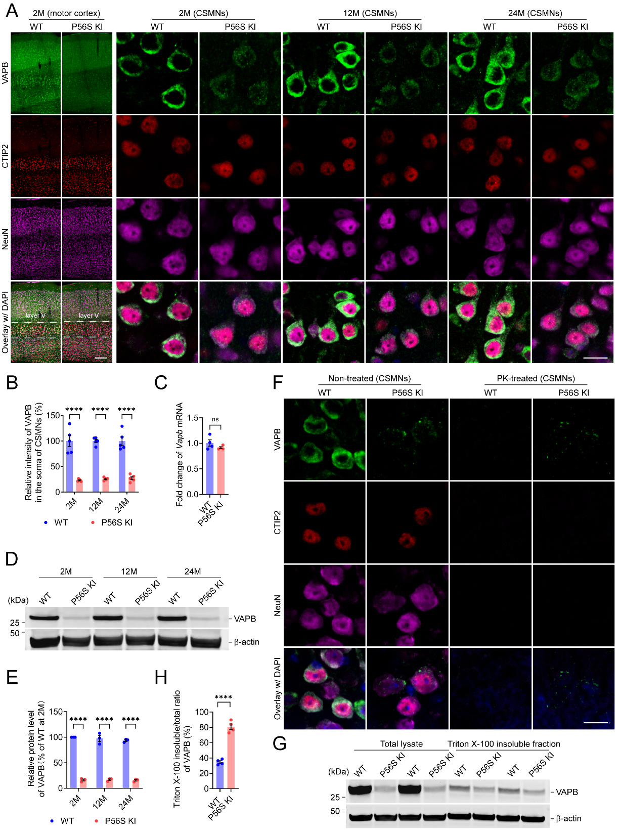 Pathogenic mechanisms of amyotrophic lateral sclerosis-linked VAPB P56S mutation in the degeneration of corticospinal motor neurons