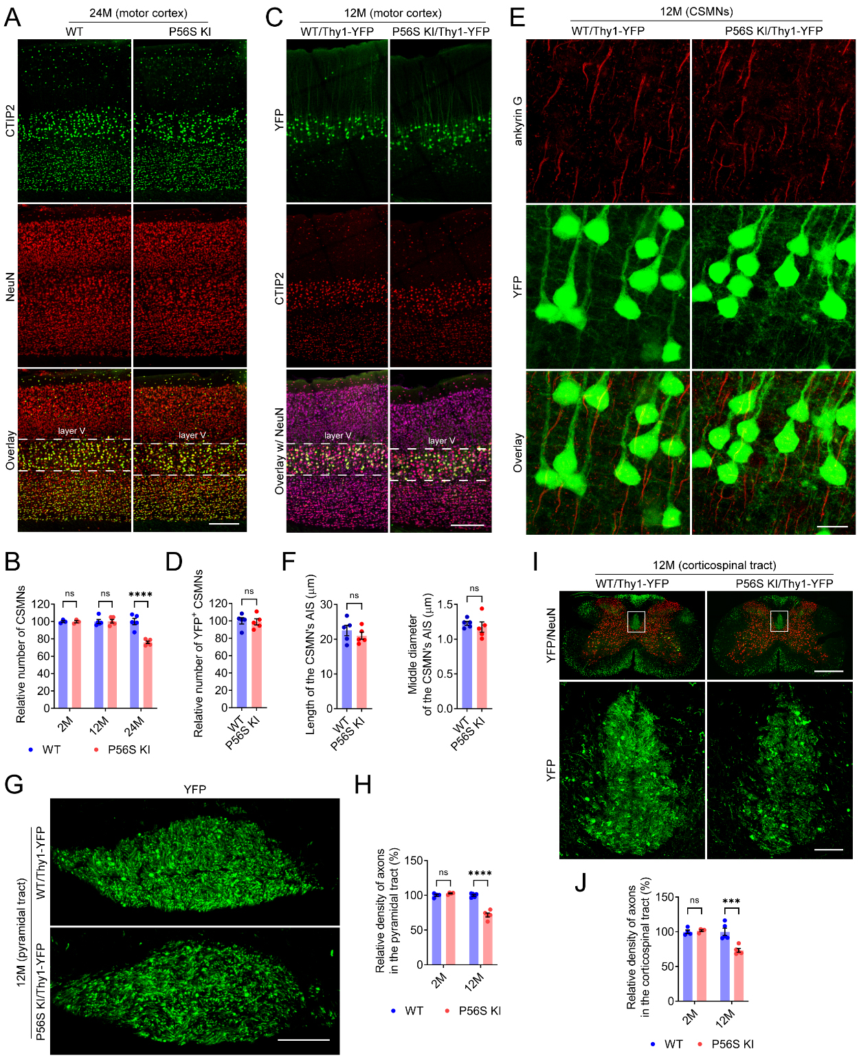 Pathogenic mechanisms of amyotrophic lateral sclerosis-linked VAPB P56S mutation in the degeneration of corticospinal motor neurons