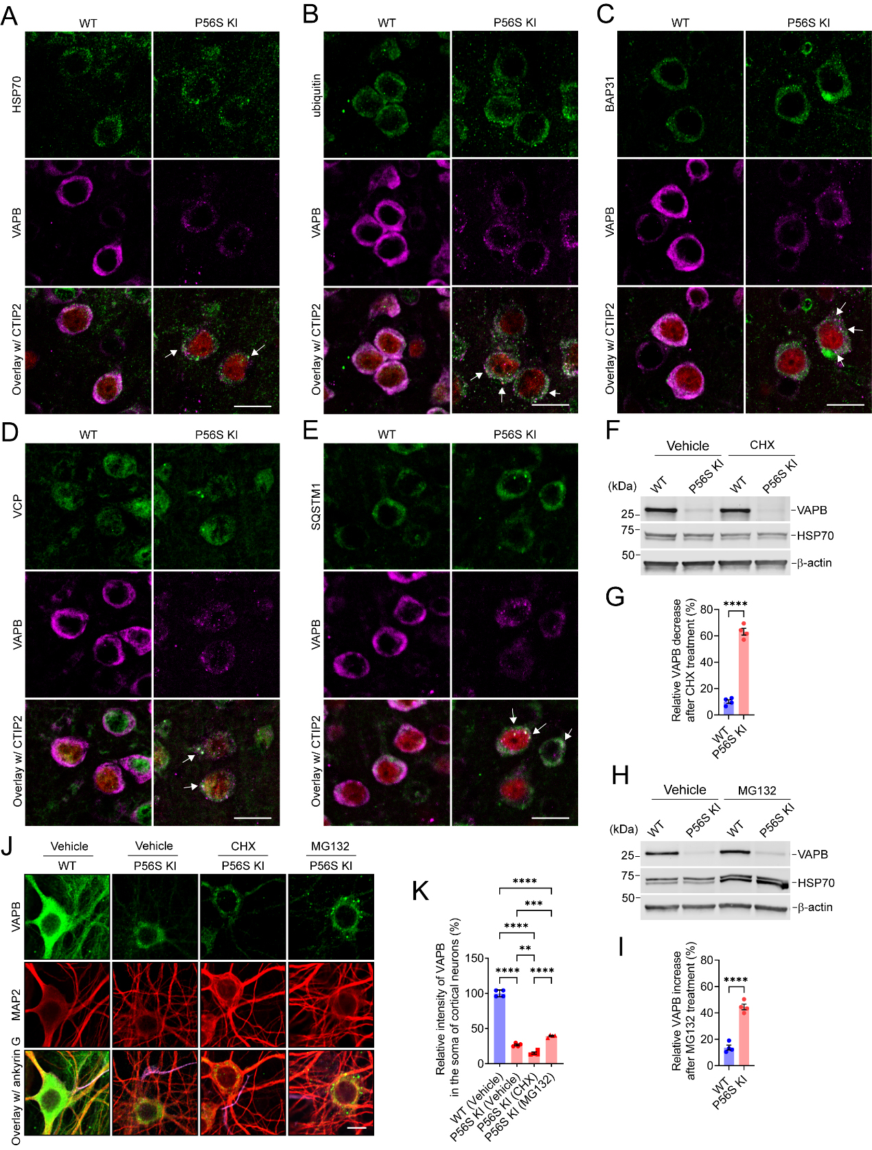 Pathogenic mechanisms of amyotrophic lateral sclerosis-linked VAPB P56S mutation in the degeneration of corticospinal motor neurons