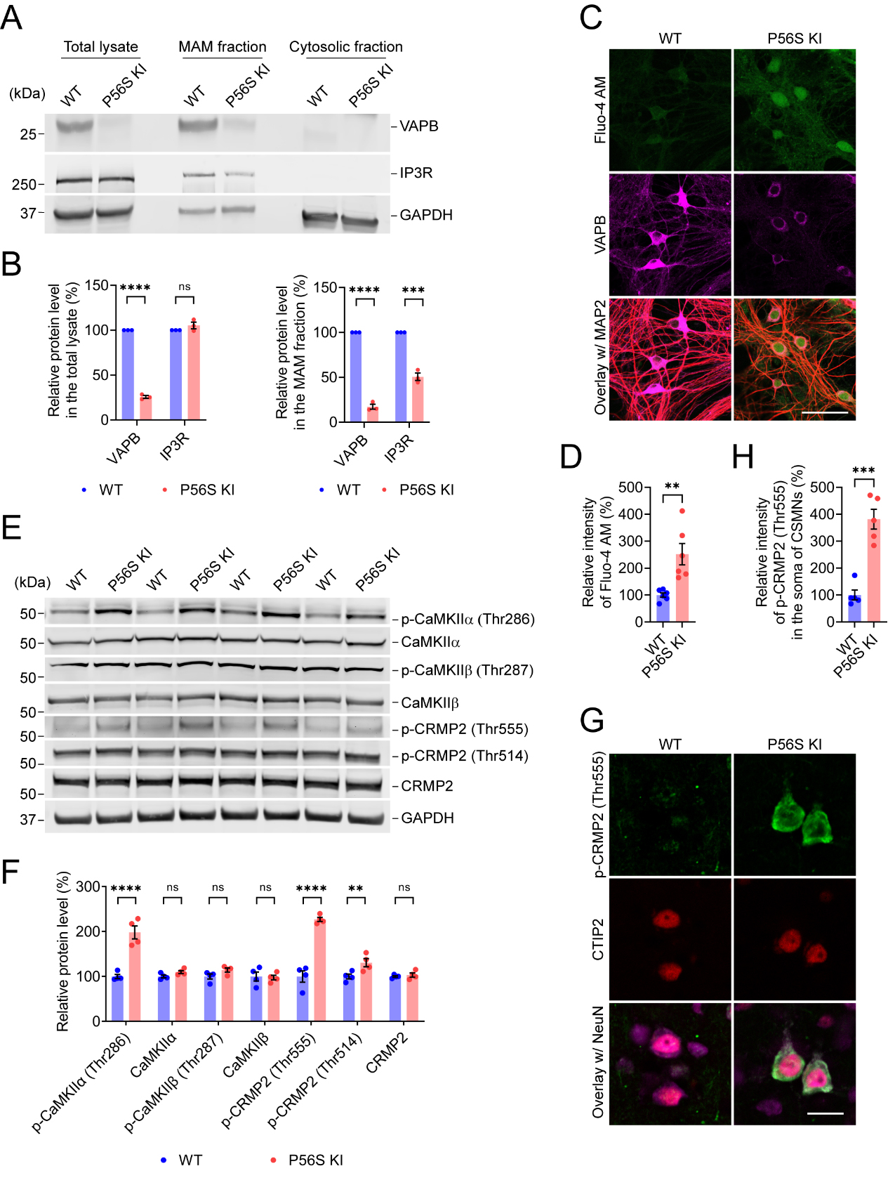 Pathogenic mechanisms of amyotrophic lateral sclerosis-linked VAPB P56S mutation in the degeneration of corticospinal motor neurons