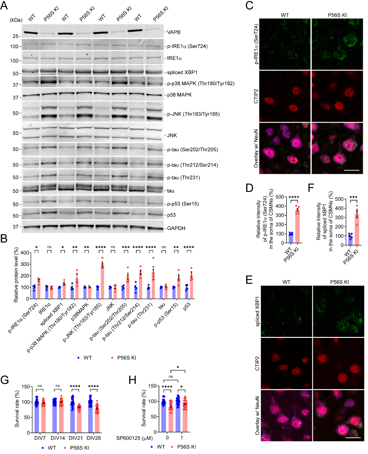 Pathogenic mechanisms of amyotrophic lateral sclerosis-linked VAPB P56S mutation in the degeneration of corticospinal motor neurons