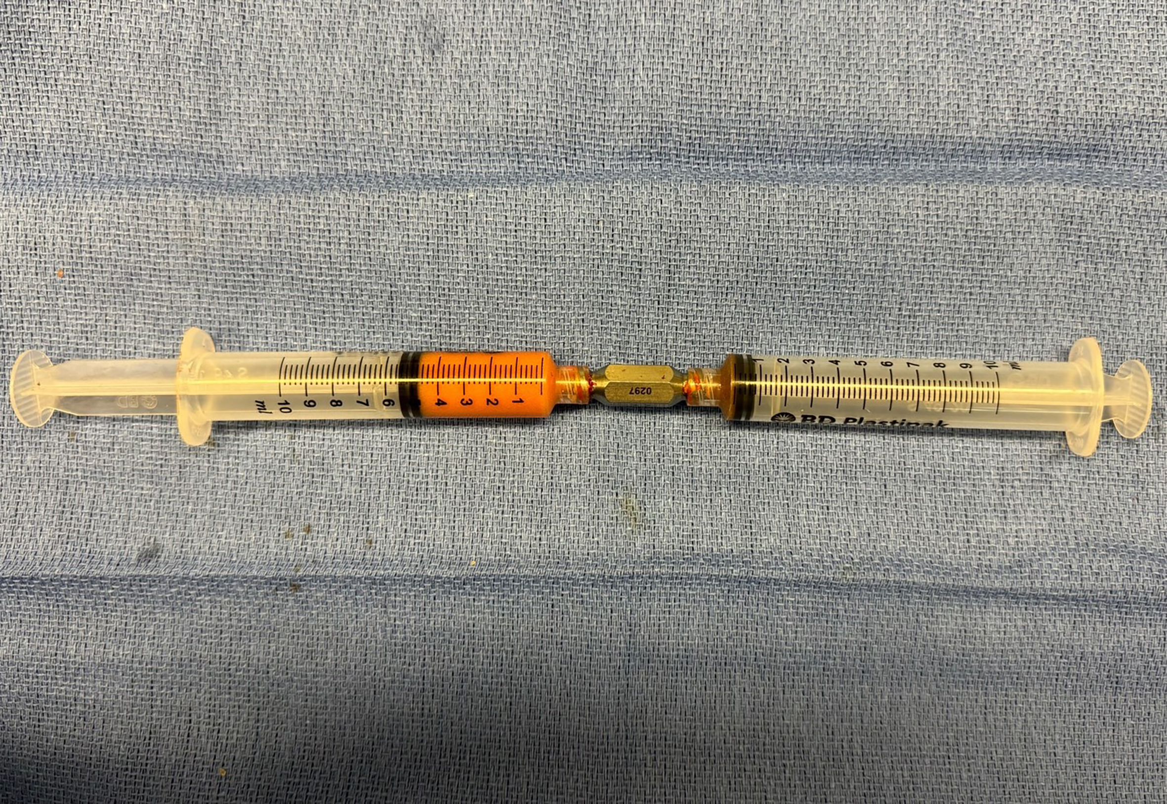 Optimizing aesthetic outcomes in immediate prepectoral breast reconstruction using sharp-needle intradermal fat grafting: a clinical experience