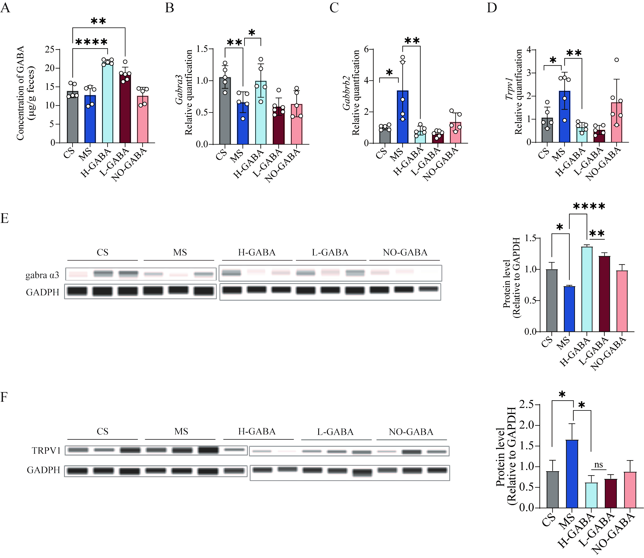 GABA-producing <i>Lactococcus lactis</i> alleviates gut dysfunction and neurobehavioral abnormalities associated with irritable bowel syndrome