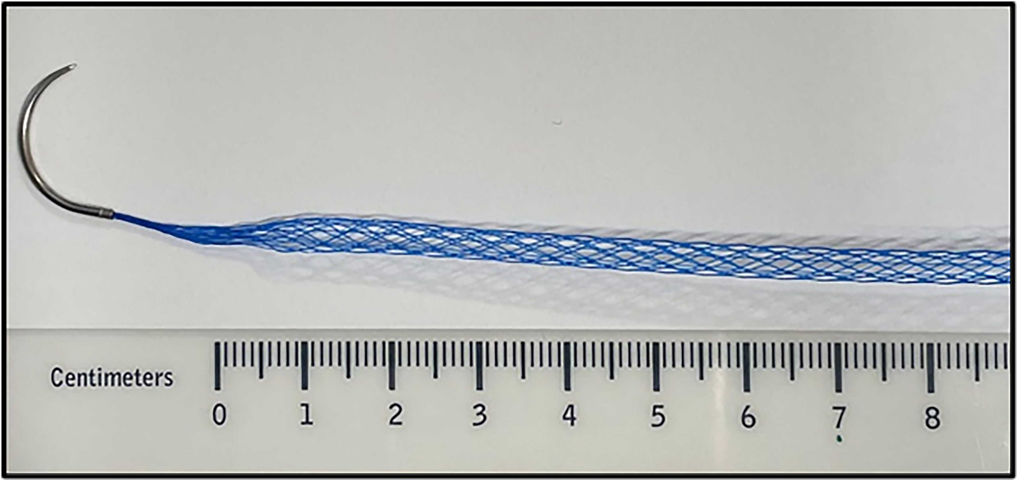 Contemporary approaches to complex and contaminated hernias: innovations in mesh technology