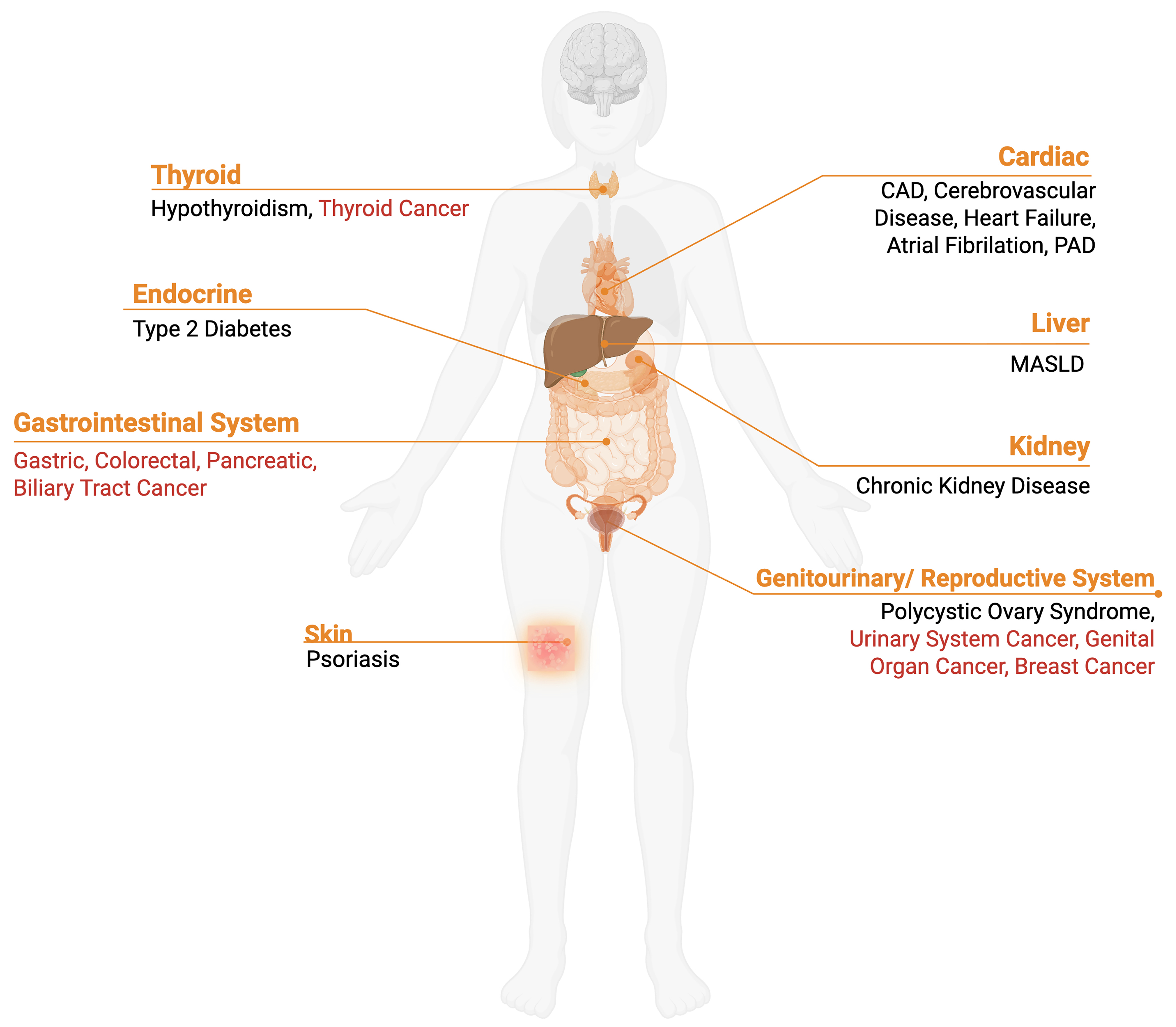 Extrahepatic manifestation of metabolic dysfunction-associated steatotic liver disease