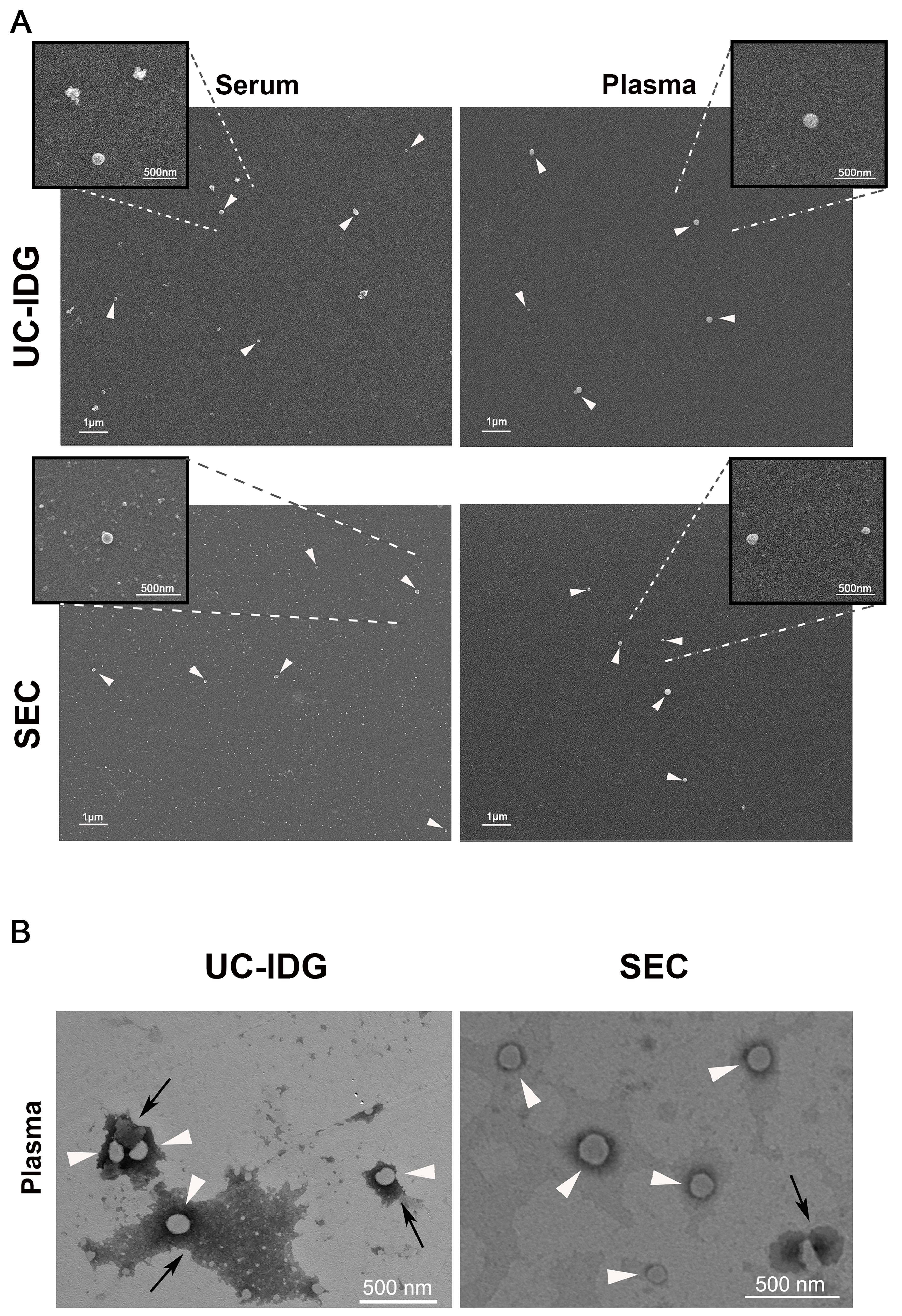 Improvement of small extracellular vesicle isolation from mouse model blood