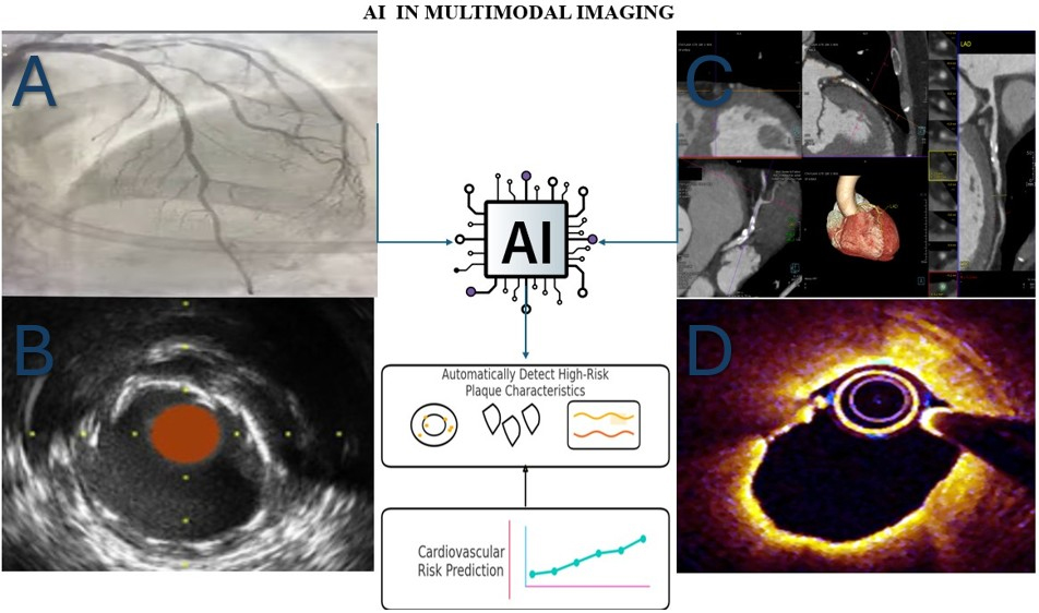 Artificial intelligence in coronary plaque characterization and risk assessment: from images to impact