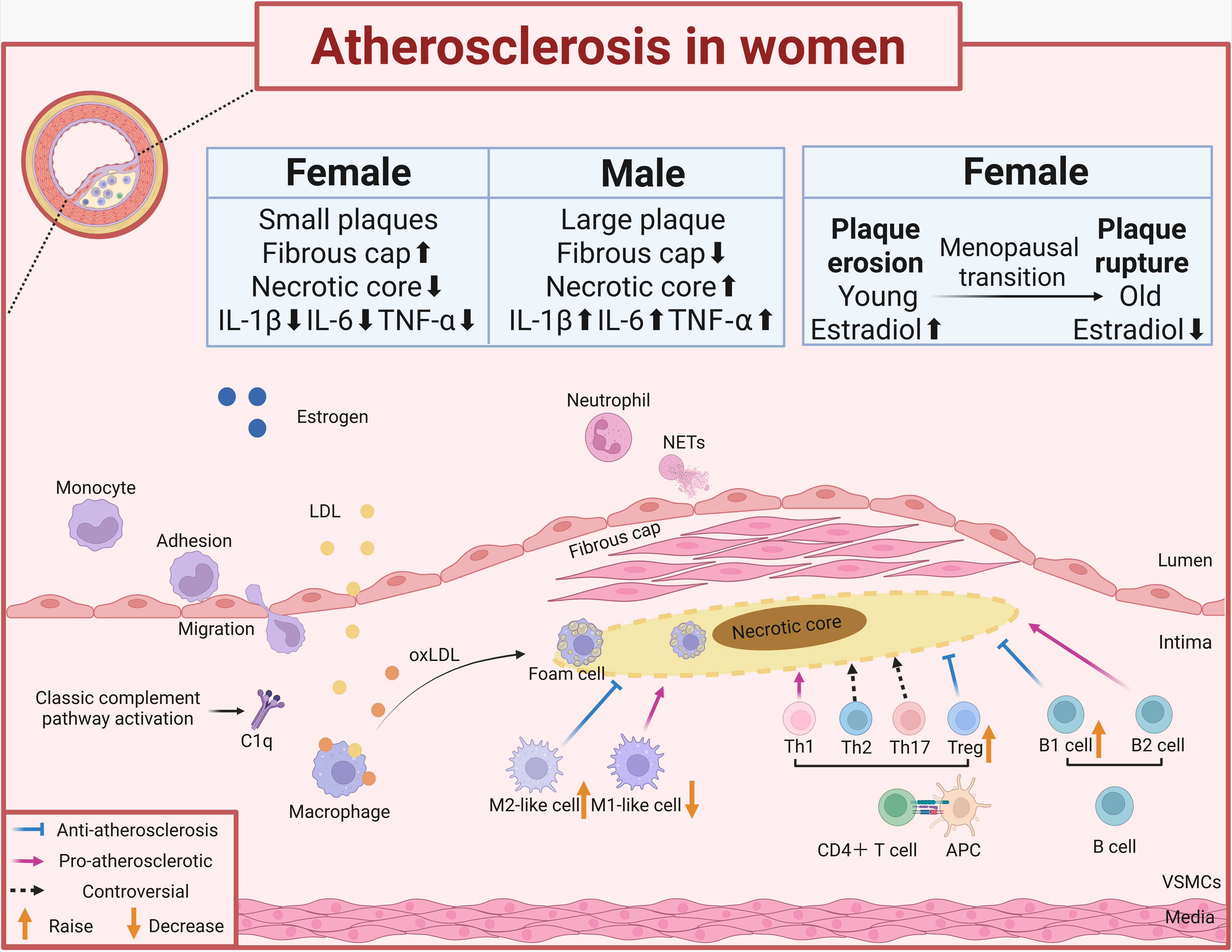 Atherosclerosis in women: immune regulation under sex differences