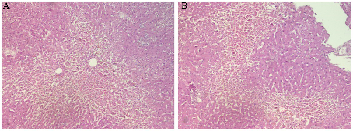 Histopathological characteristics in livers of deceased patients with COVID-19