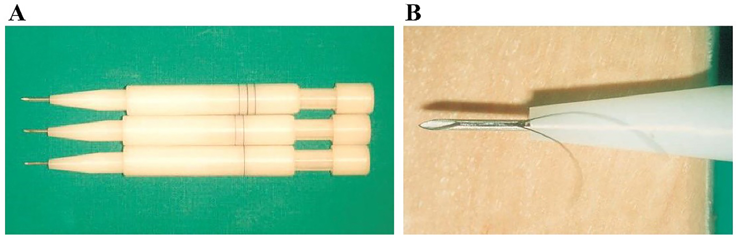 Microneedle-mediated therapies in hair loss: applications, mechanisms, and future directions