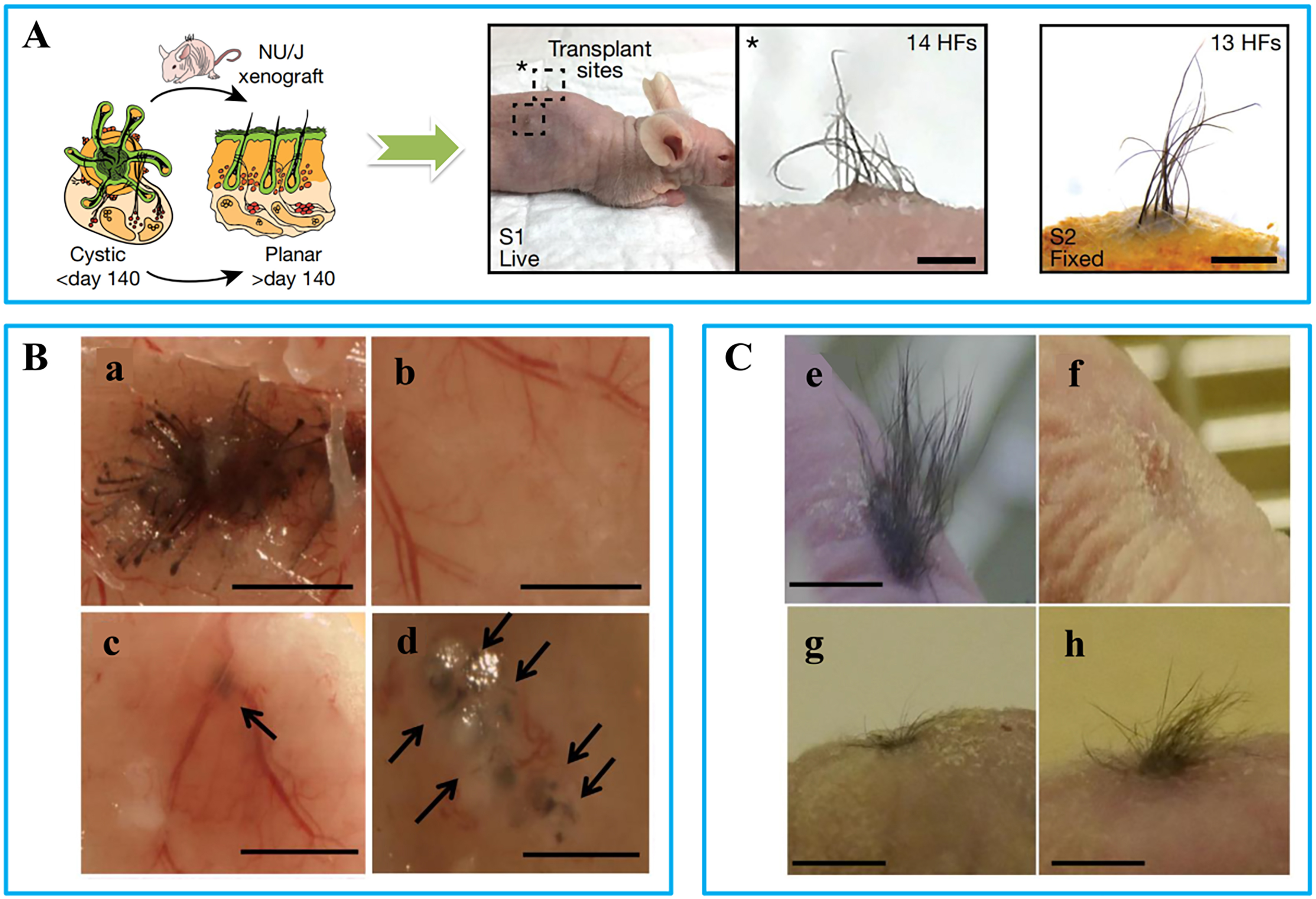 Microneedle-mediated therapies in hair loss: applications, mechanisms, and future directions
