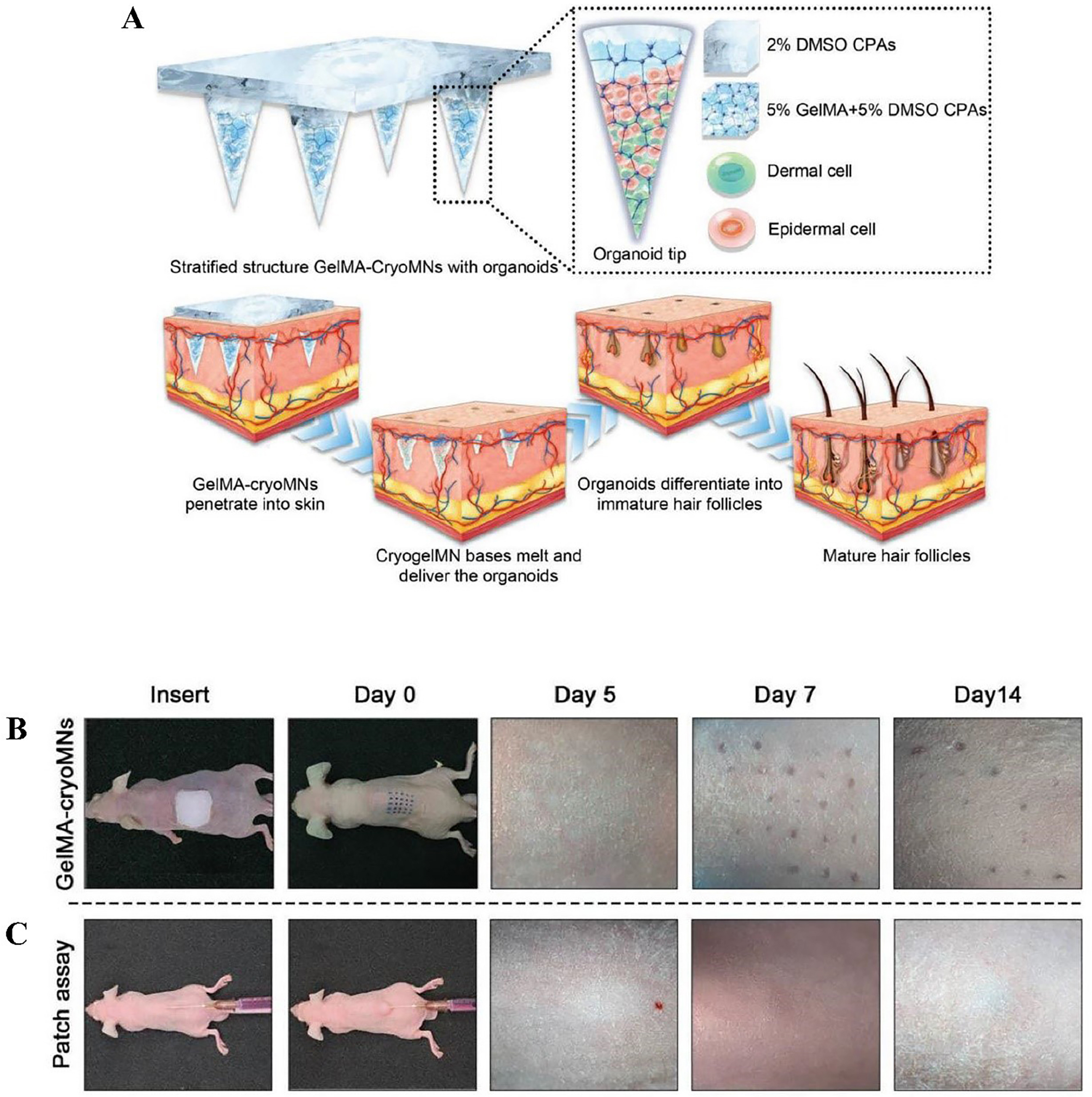 Microneedle-mediated therapies in hair loss: applications, mechanisms, and future directions
