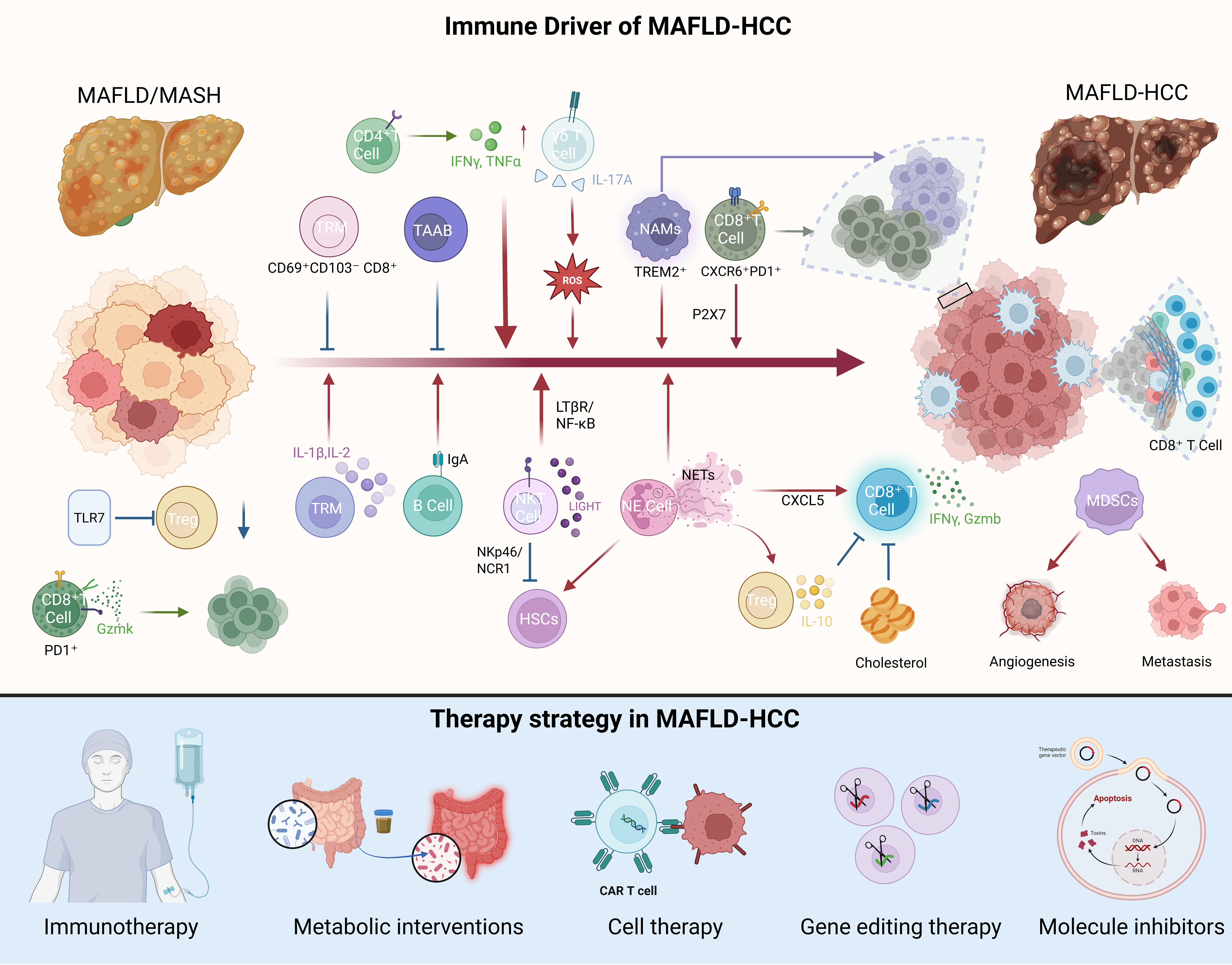 Immune microenvironment and immunotherapy strategies in MAFLD-related hepatocellular carcinoma