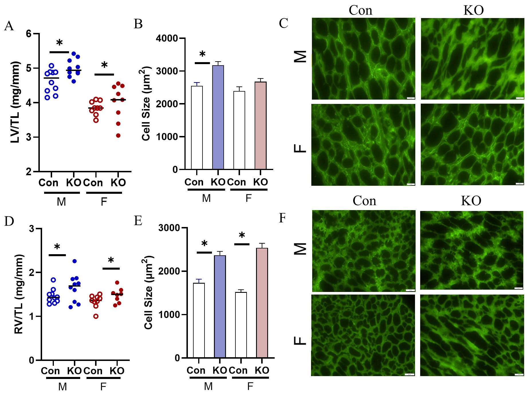 Global deletion of potassium channel Kv1.5 causes biventricular heart failure