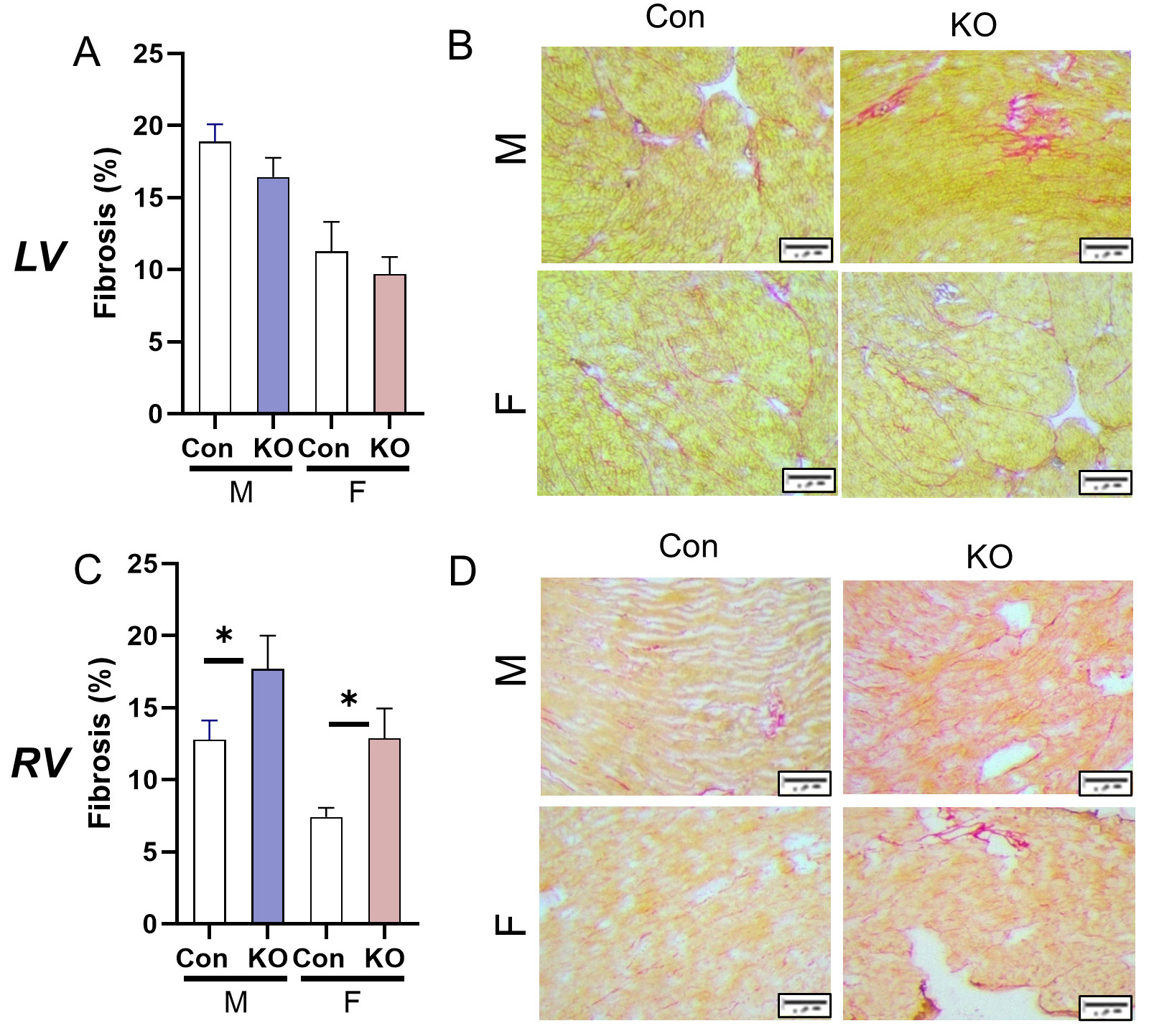 Global deletion of potassium channel Kv1.5 causes biventricular heart failure