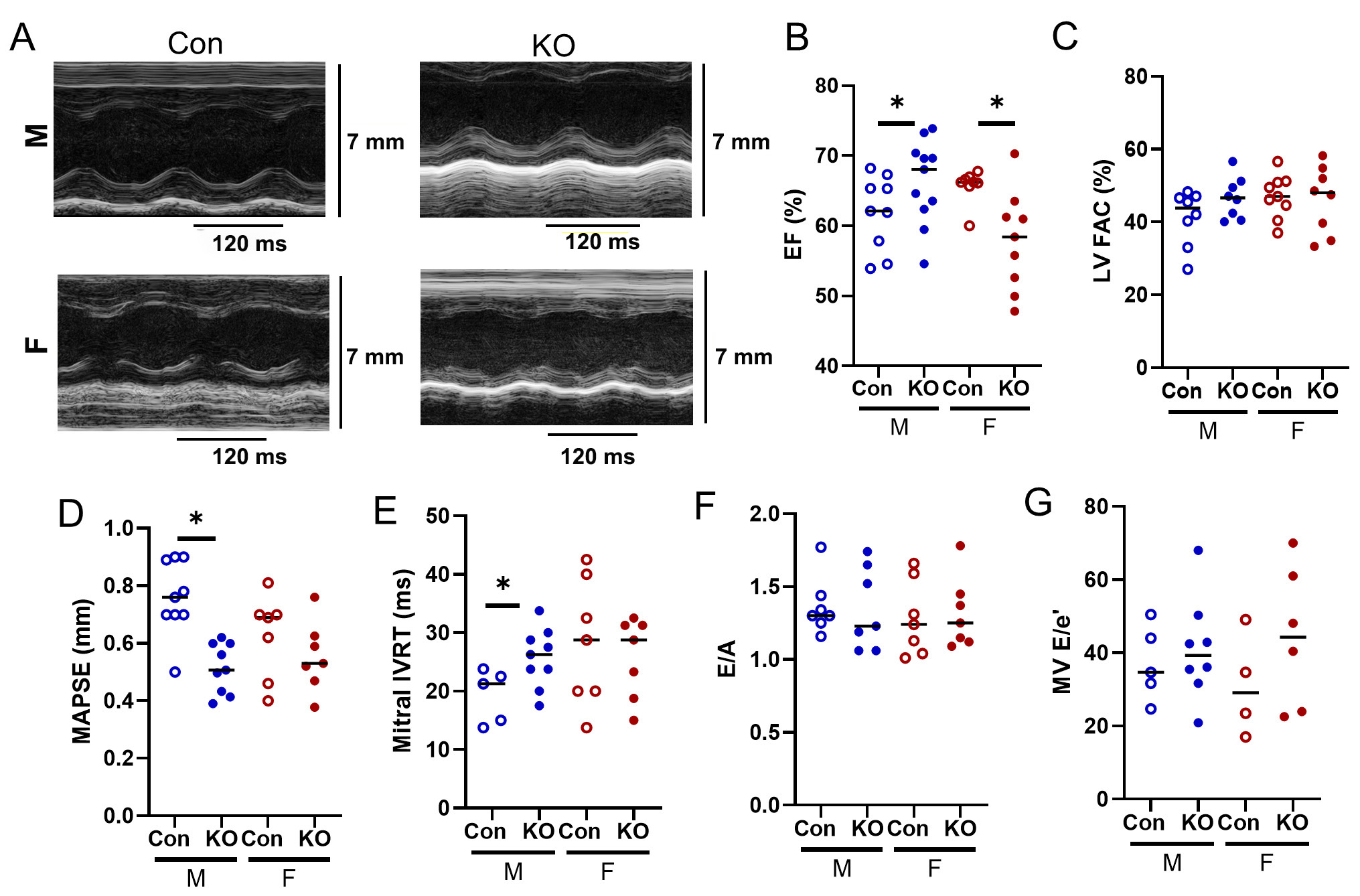 Global deletion of potassium channel Kv1.5 causes biventricular heart failure