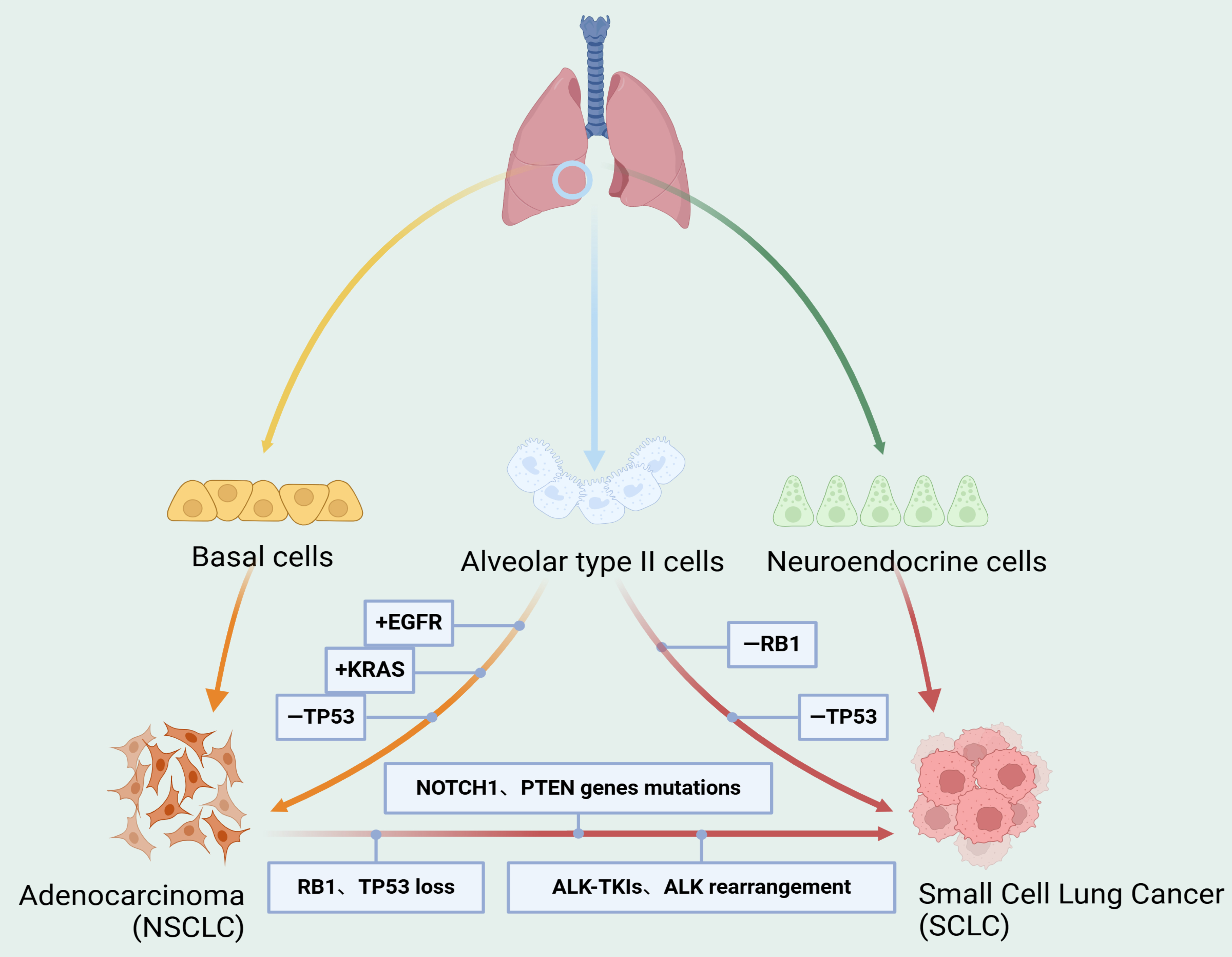 New advances in understanding the mechanisms and treatment challenges of ALK-targeted therapy resistance in lung cancer