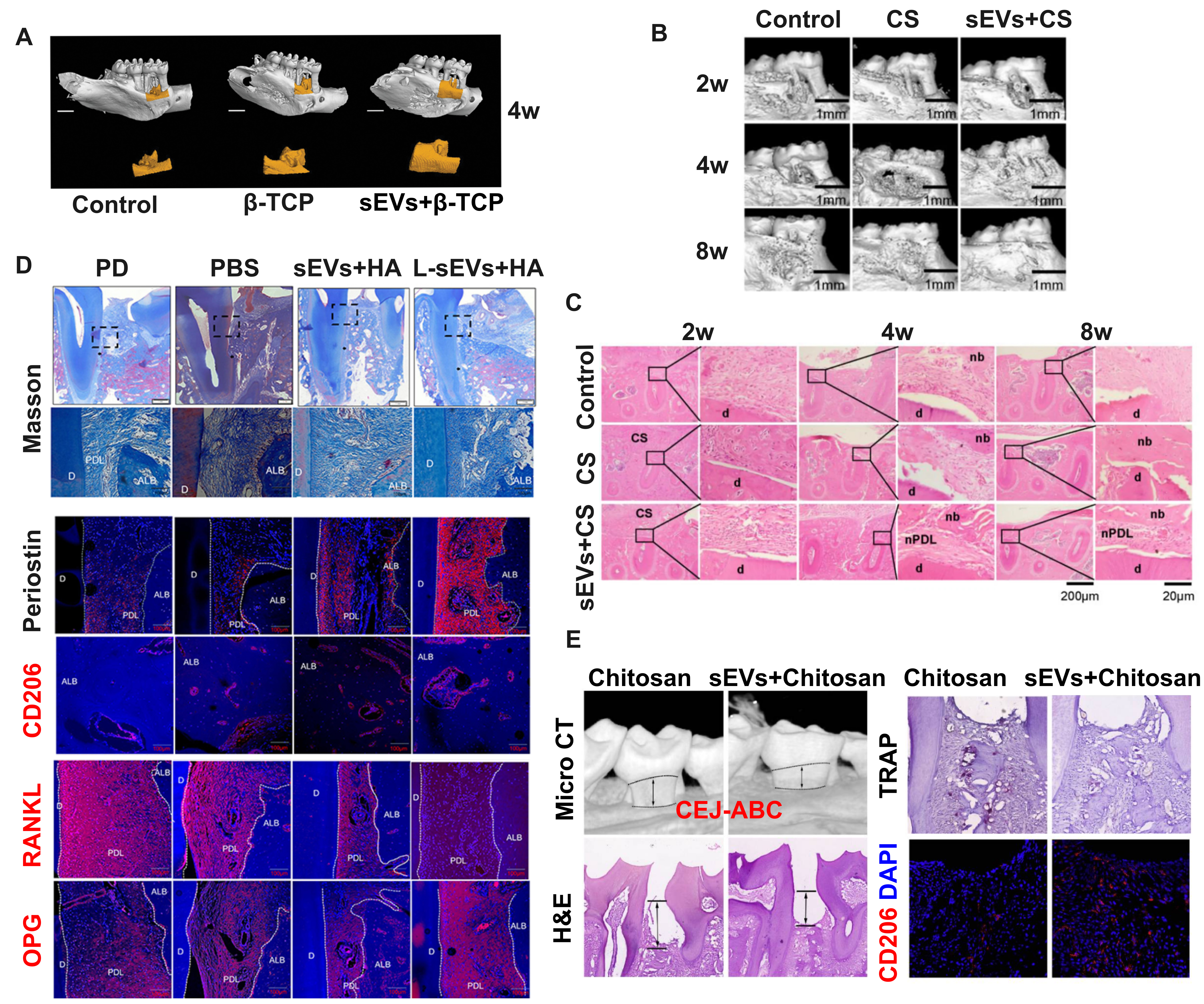 Synergistic potentials of small extracellular vesicles, biomaterials, and 3D bioprinting in periodontal regeneration: a scoping review