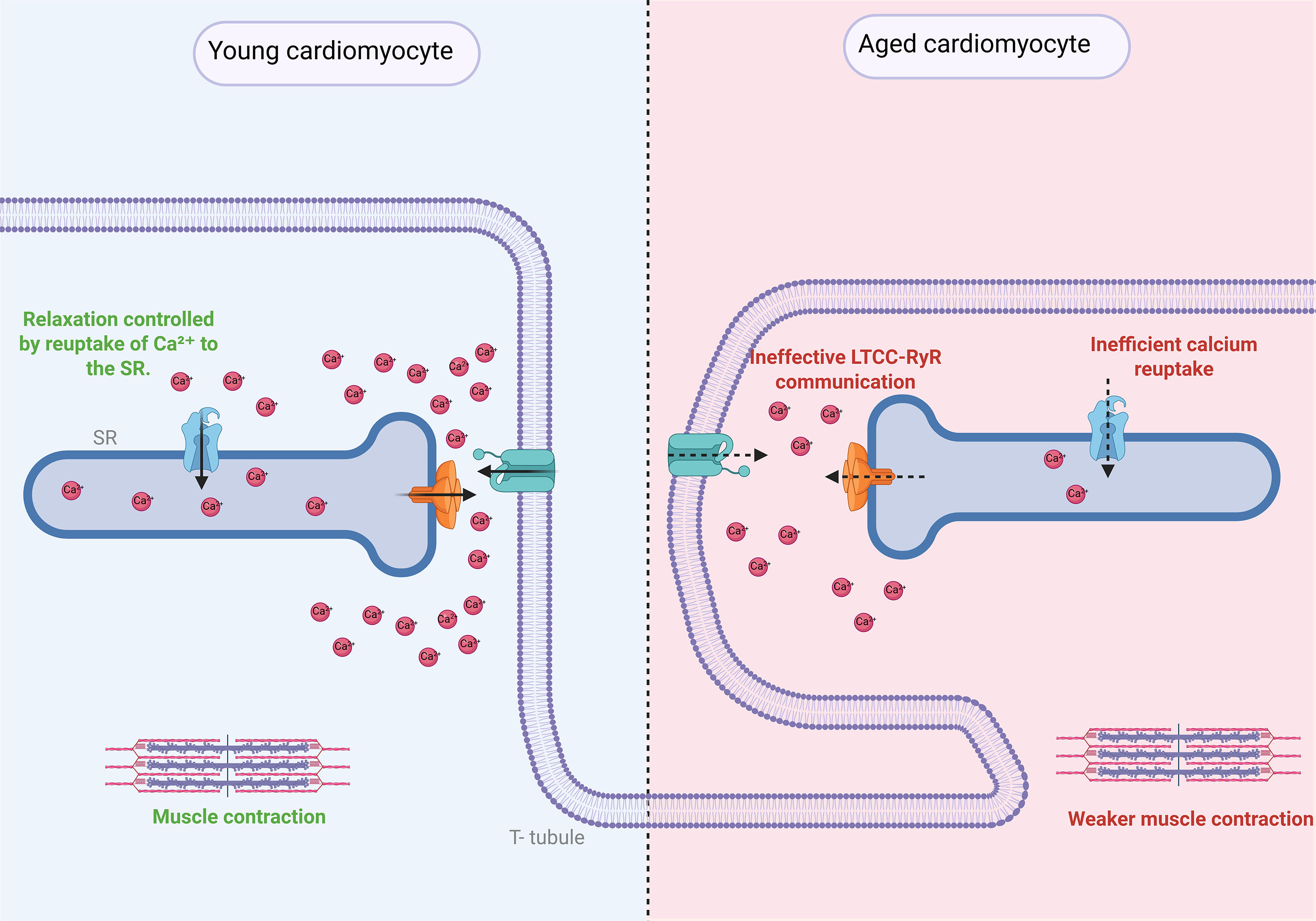 Aging-driven organelle miscommunication in the failing heart