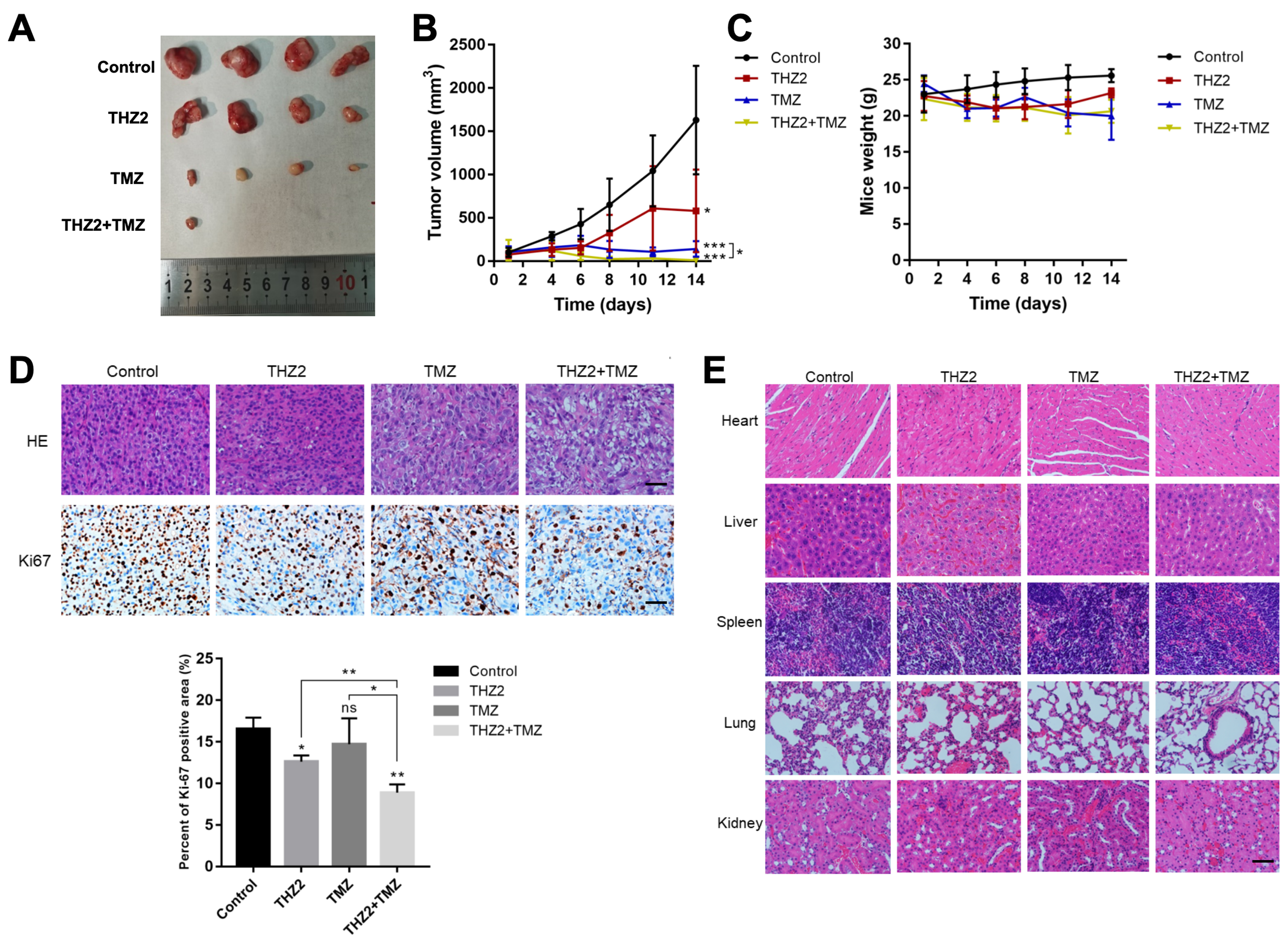 Super-enhancer inhibitors THZ2 and JQ1 reverse temozolomide resistance in glioblastoma by suppressing SE-driven SOX9 expression