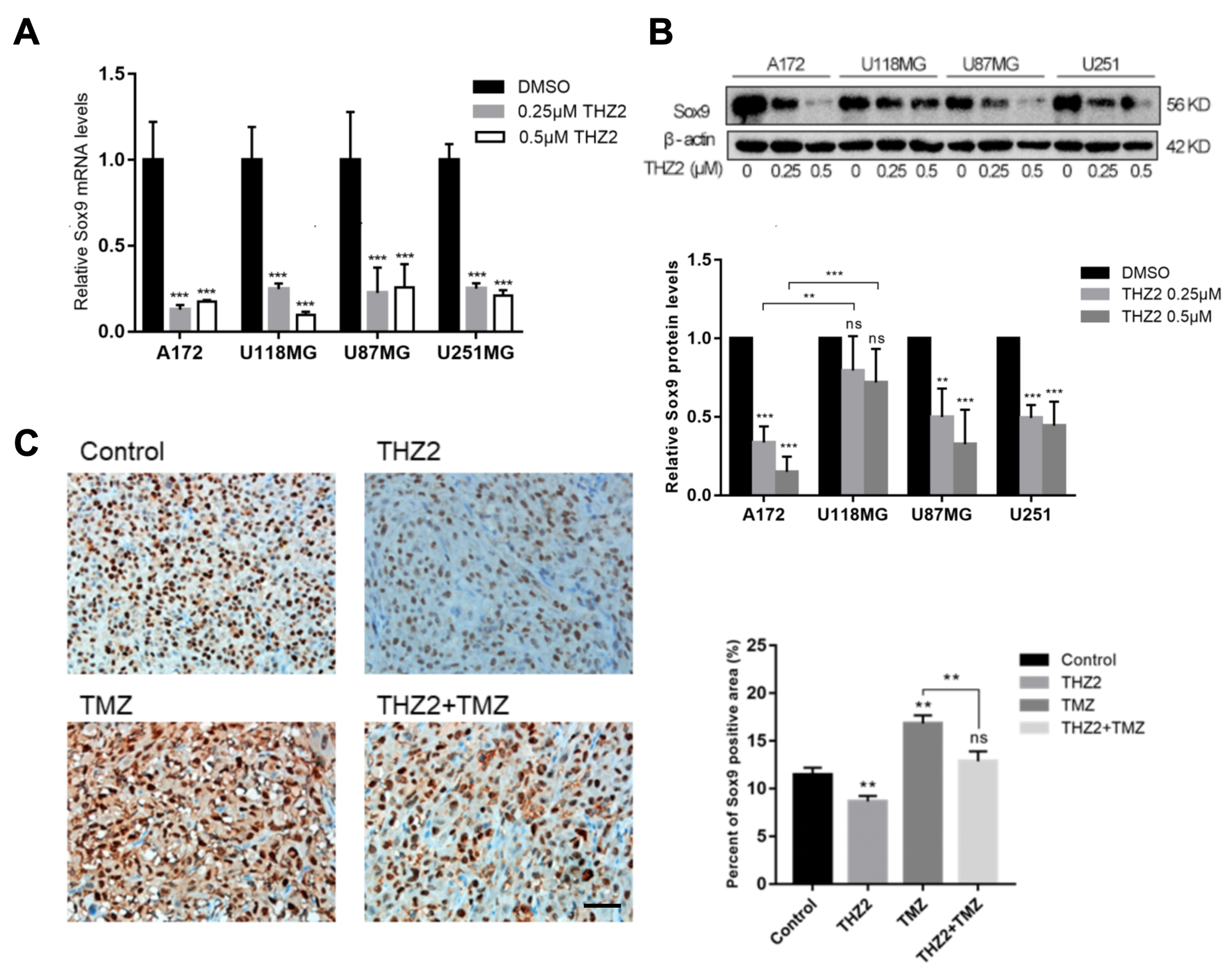 Super-enhancer inhibitors THZ2 and JQ1 reverse temozolomide resistance in glioblastoma by suppressing SE-driven SOX9 expression