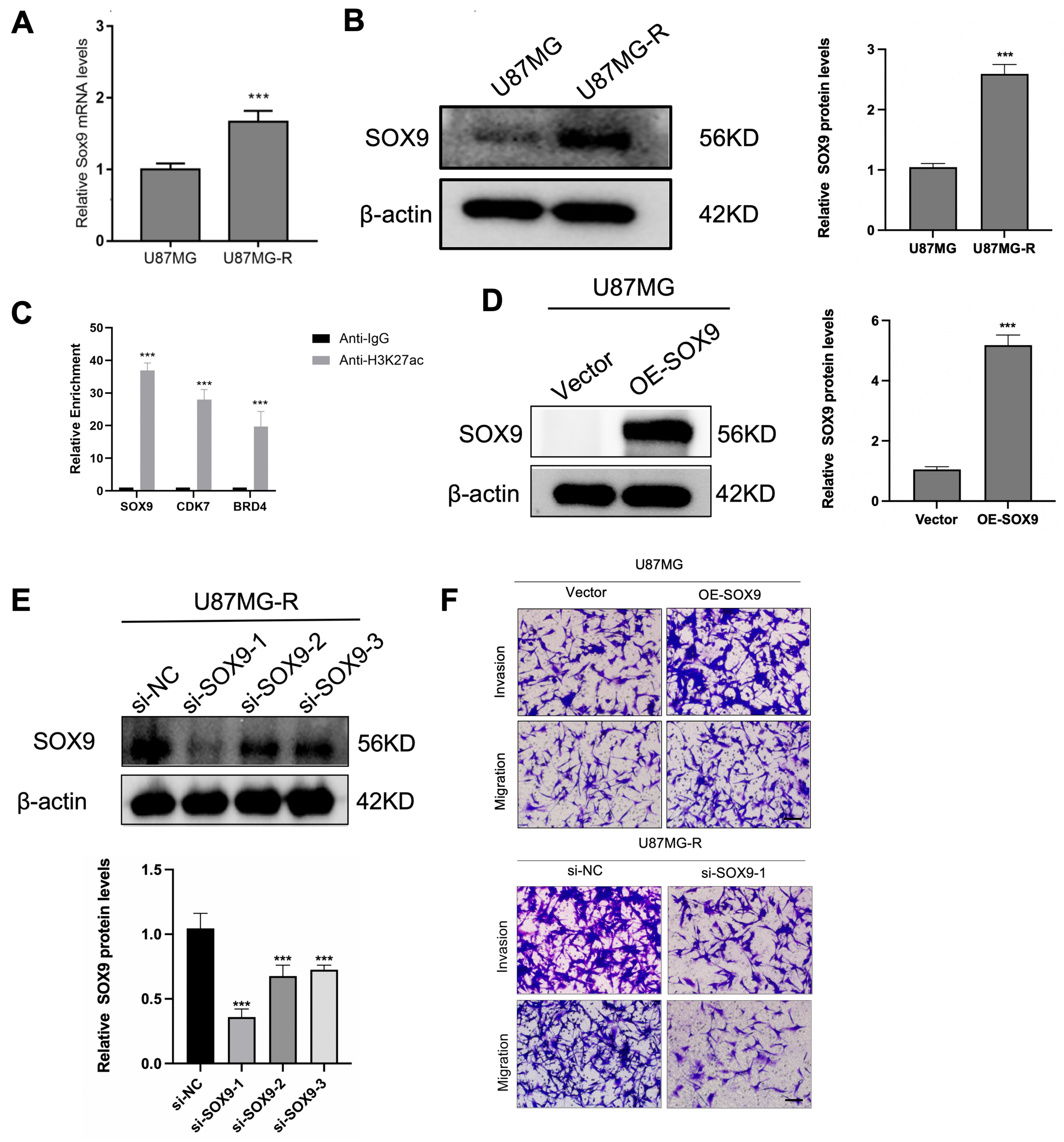 Super-enhancer inhibitors THZ2 and JQ1 reverse temozolomide resistance in glioblastoma by suppressing SE-driven SOX9 expression