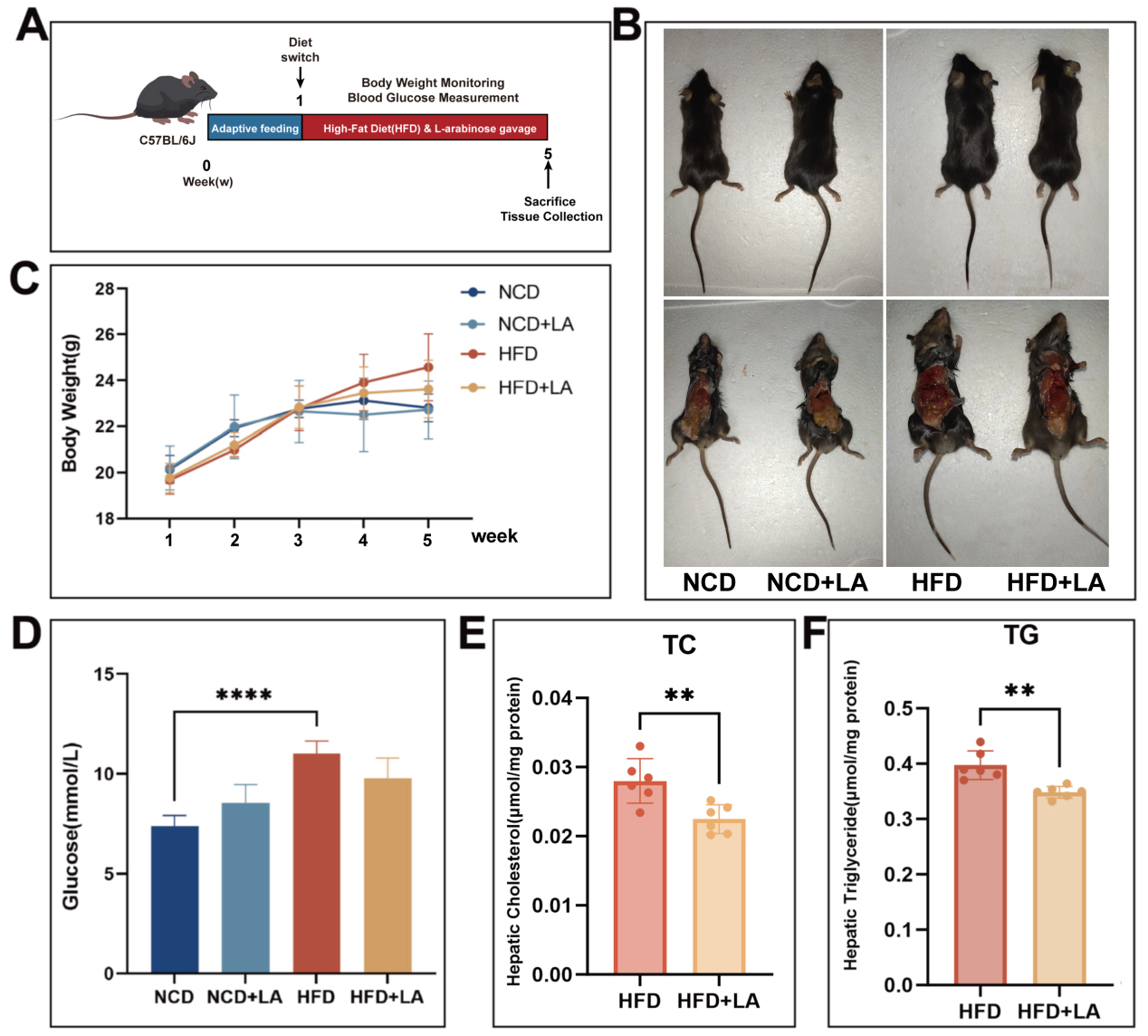 Short-term L-arabinose administration alleviates MASLD by remodeling gut microbiota and activating hepatic ATF5-dependent mitochondrial unfolded protein response