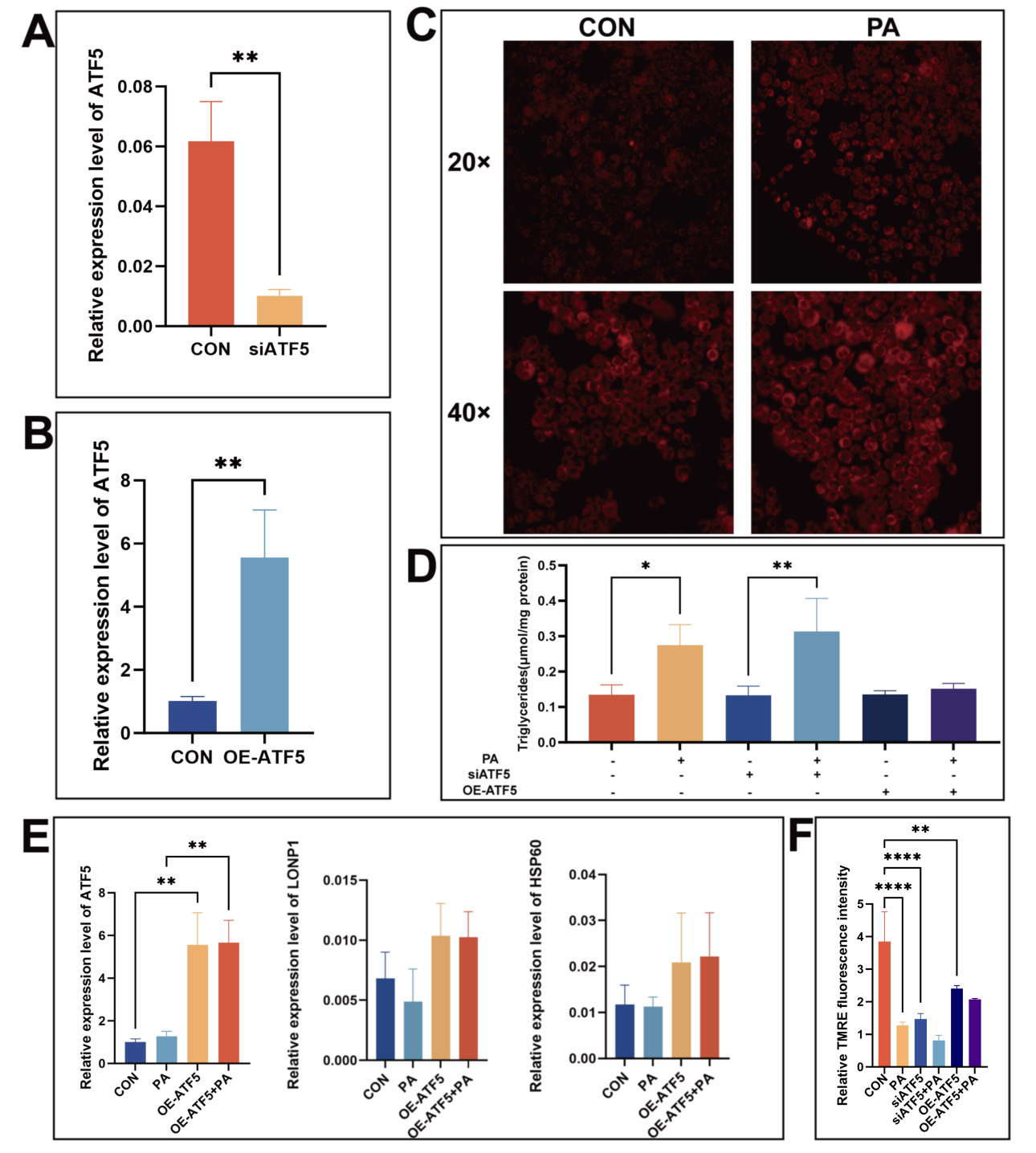 Short-term L-arabinose administration alleviates MASLD by remodeling gut microbiota and activating hepatic ATF5-dependent mitochondrial unfolded protein response