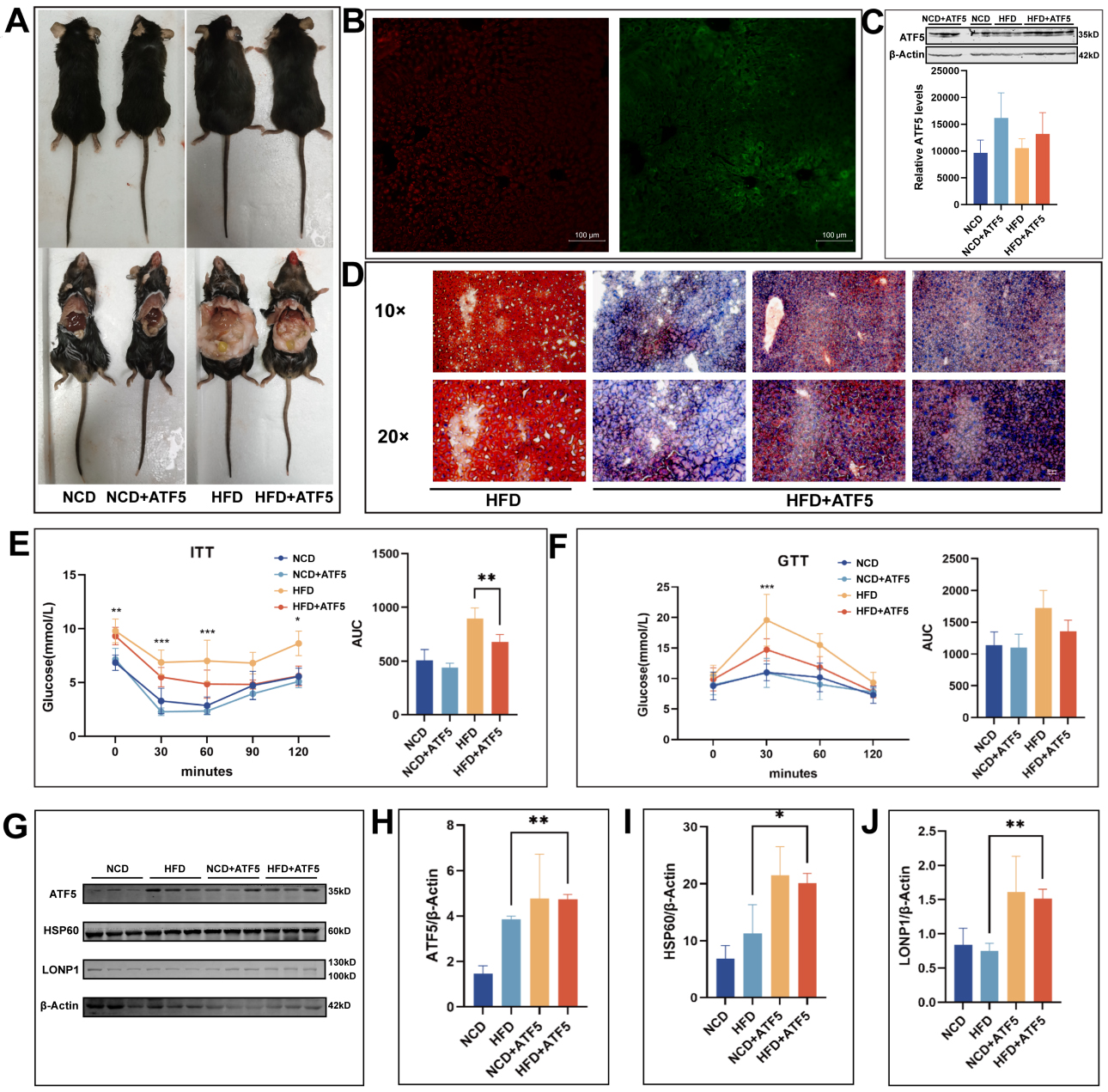 Short-term L-arabinose administration alleviates MASLD by remodeling gut microbiota and activating hepatic ATF5-dependent mitochondrial unfolded protein response