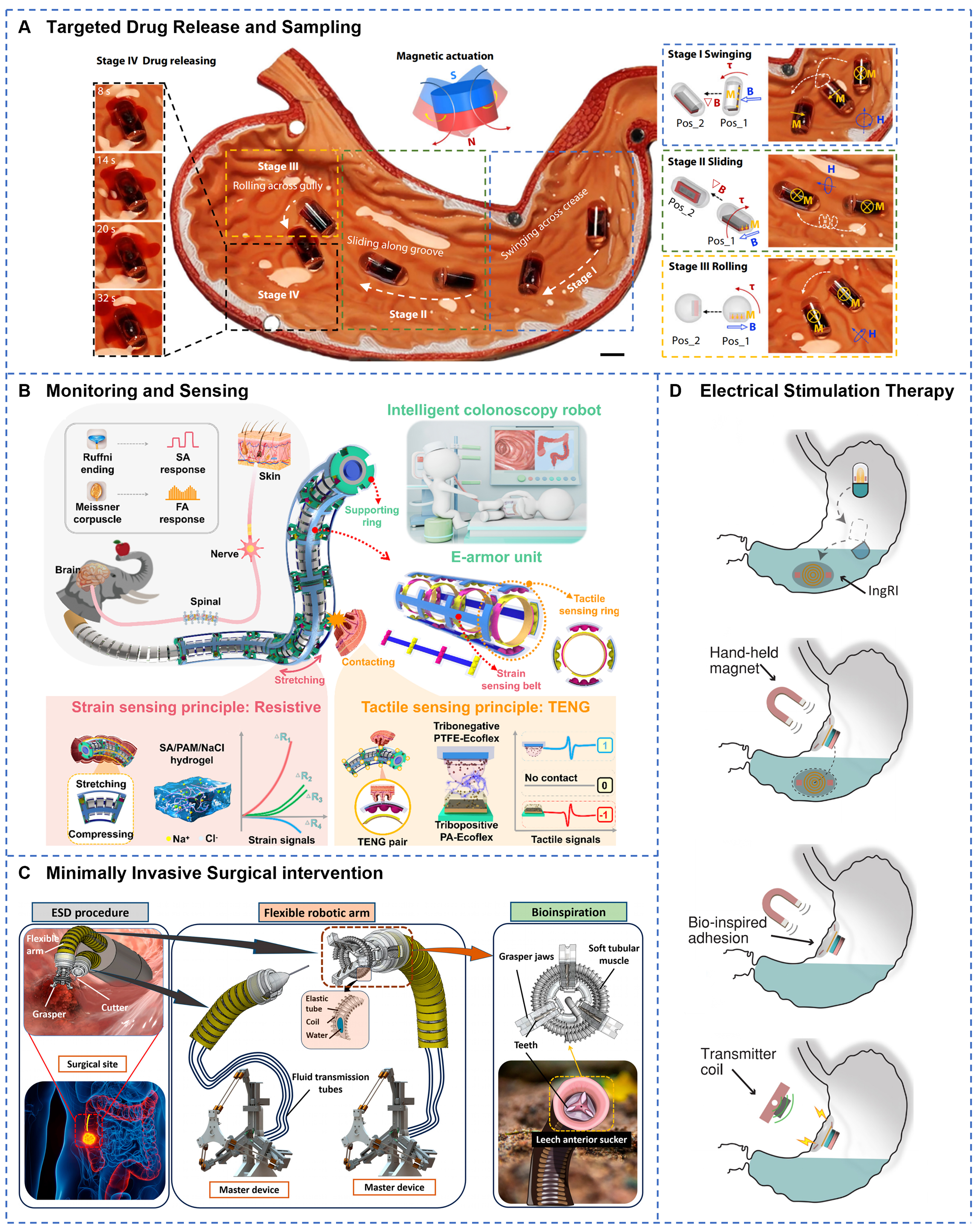 Advances of soft robotics for gastrointestinal tract applications