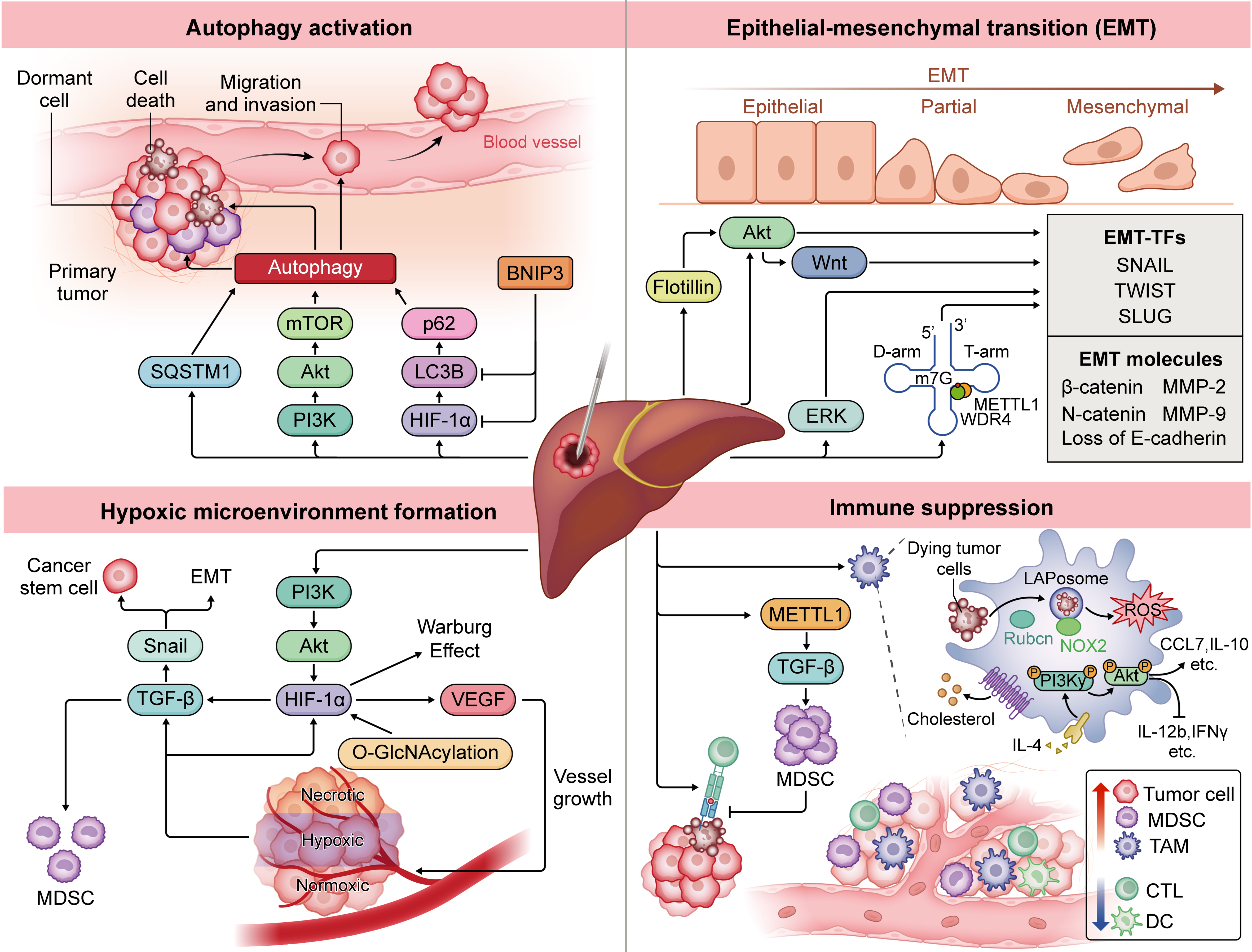 Thermal ablation therapy for hepatocellular carcinoma: recurrence mechanisms and intervention strategies