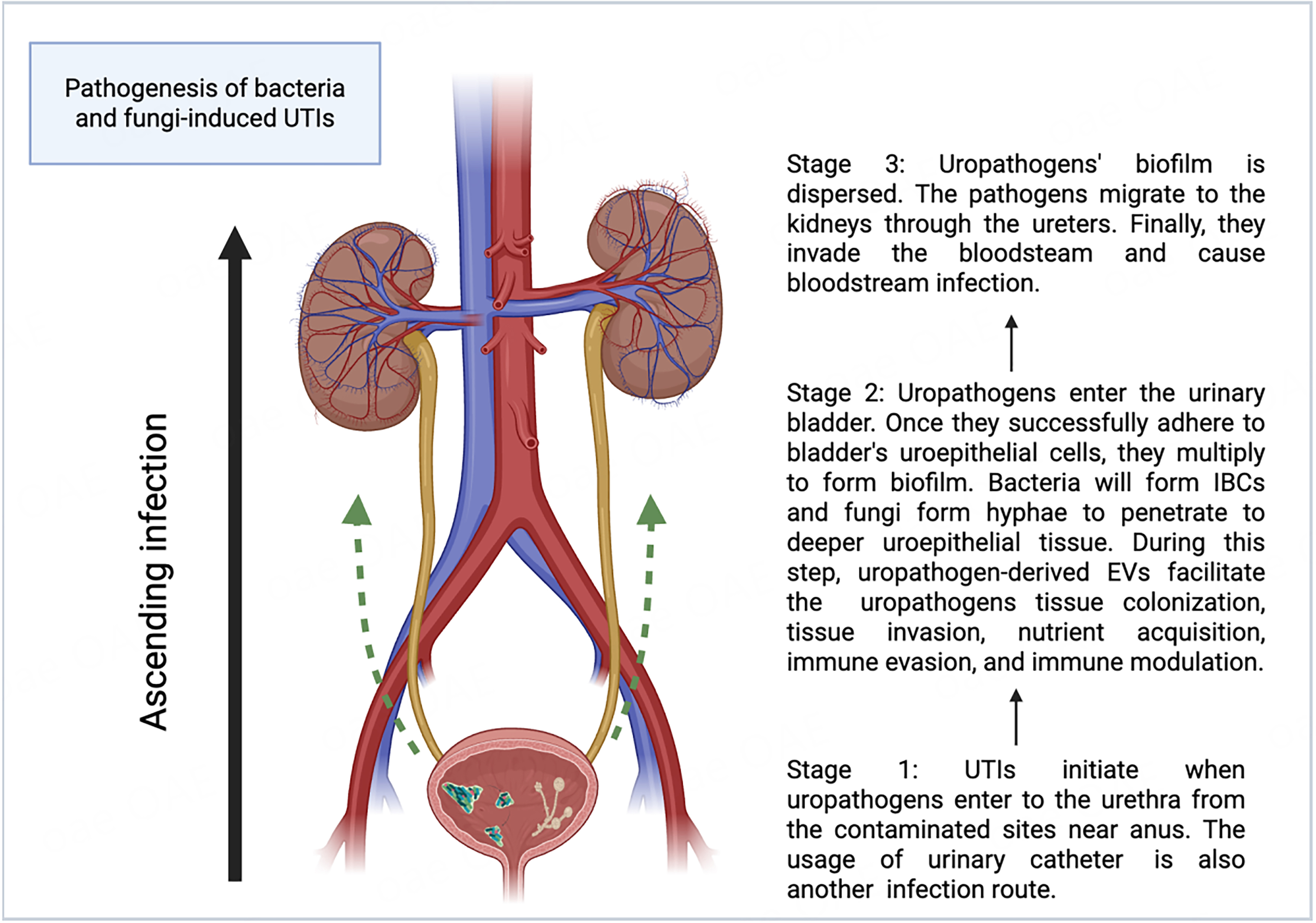 Extracellular vesicles from bacteria and fungi: mechanistic insights and implications for urinary tract infections