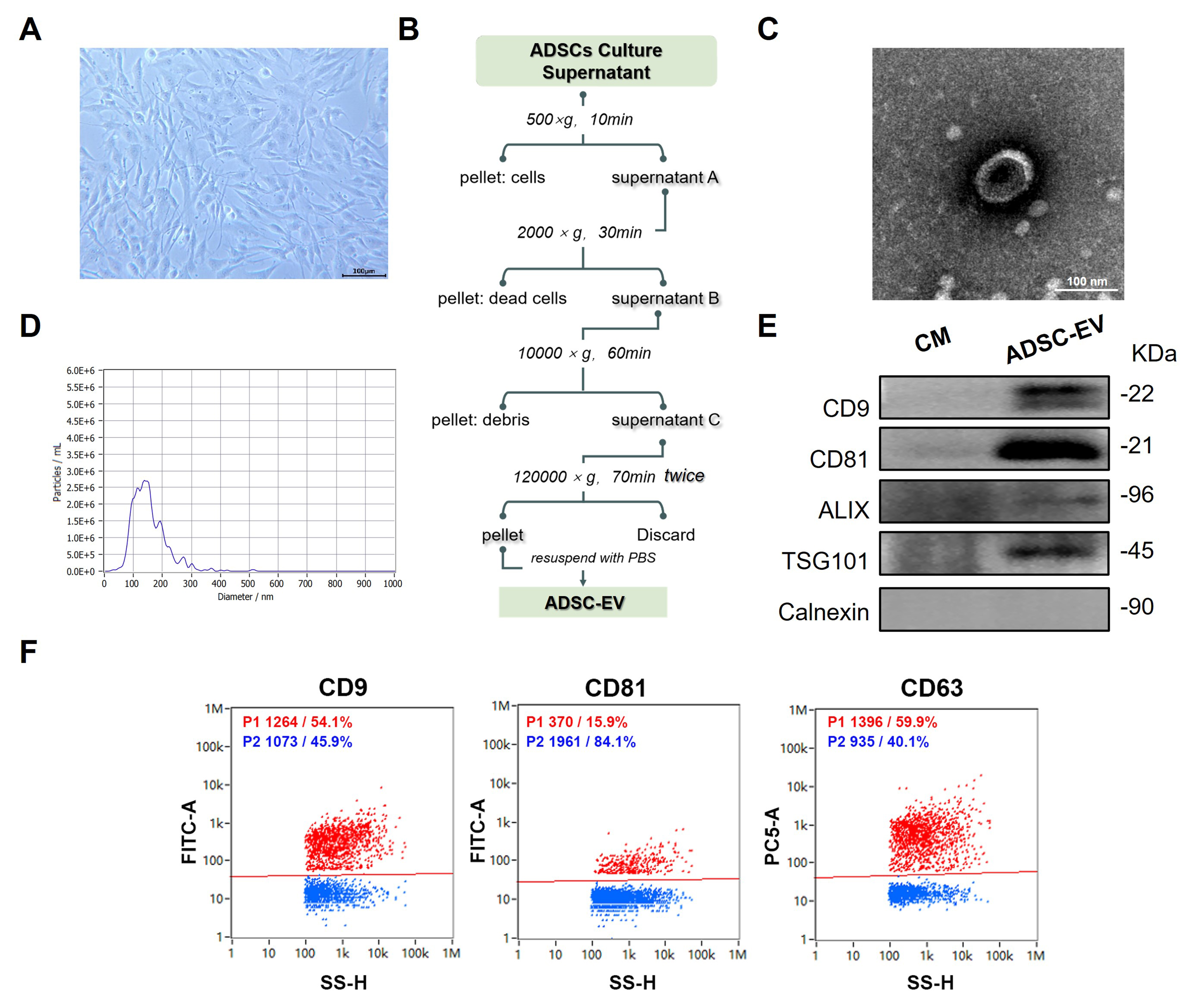 Adipose-derived stem cell extracellular vesicles attenuate liver fibrosis via restoration of gut barrier function and modulation of gut microbiota